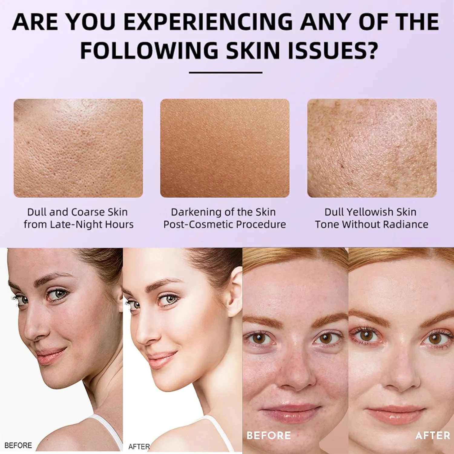10% Niacinamide  4% TXA Serum - Niacinamide Serum for Face - Redness Reducing Skin Care - Face Skin Care to Firm,Smooth,Nourish - Pore Minimizer - Skincare for Women