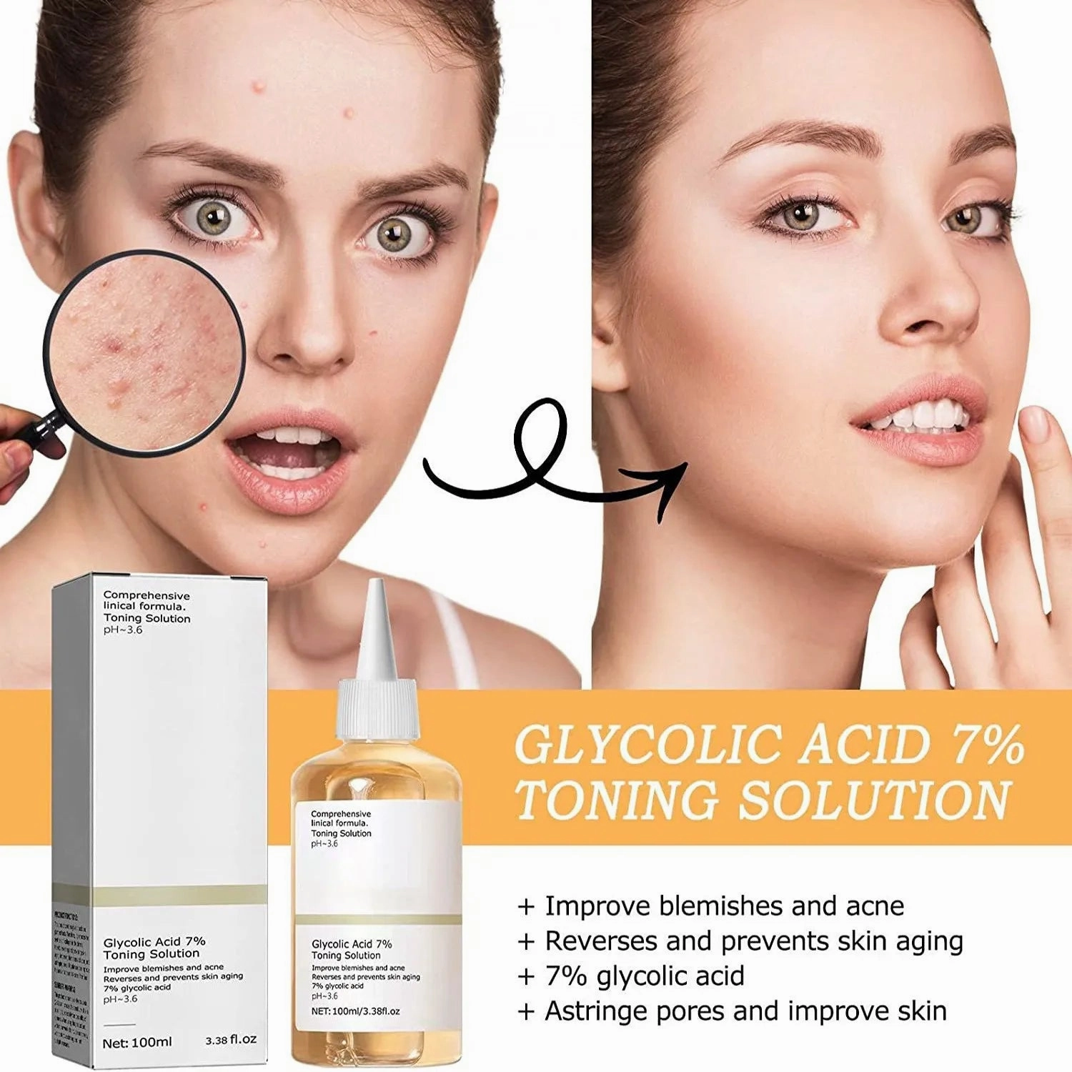 100ml Glycolic Acid Toning Solution – Acne Remover & Skin Firming Care