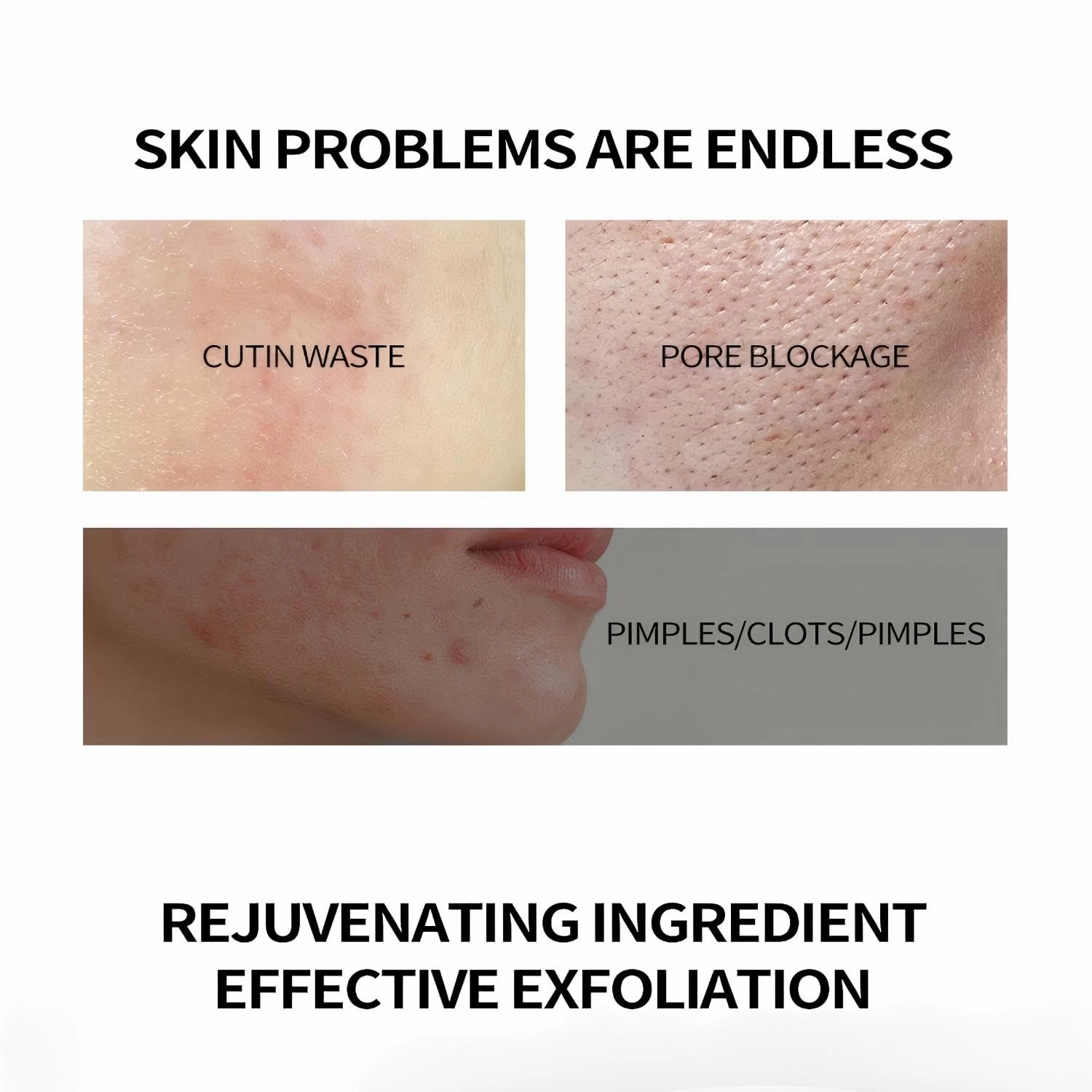 ‌Advanced AHA 30%   BHA 2% Exfoliating Serum: Unclogs Pores, Brightens Dullness, Controls Oil & Acne. Improves Rough Skin Texture for Smoother, Clearer, Glowing Complexion (2 Fl Oz,2)