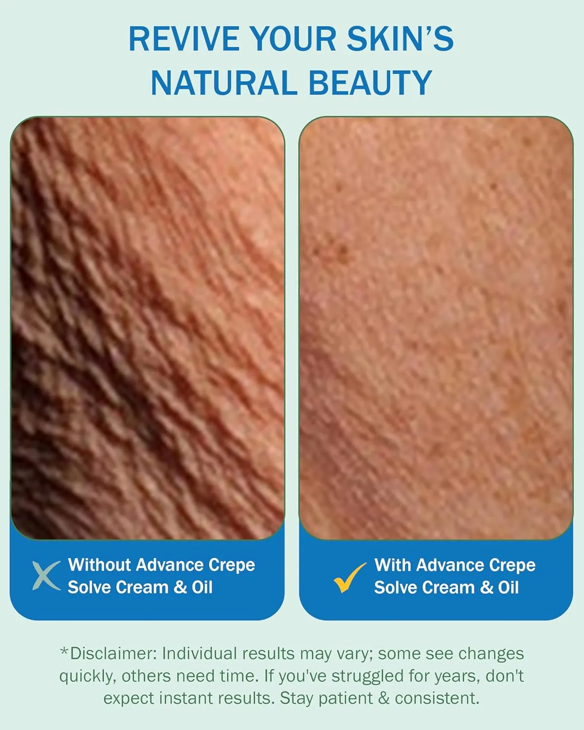 Advance Crepe Solve Skin Firming Cream & Moisturizing Body Oil Set - Made with Natural Oils, Licorice Root & Chamomile Extract - Face & Body Serum & Crepey Skin Smoothing Cream