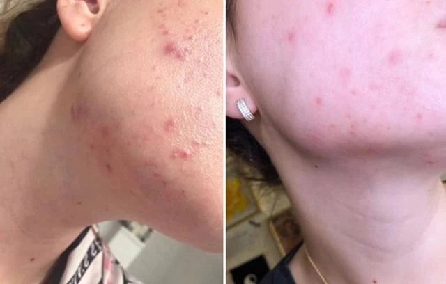 Algae Retinol Face Oil