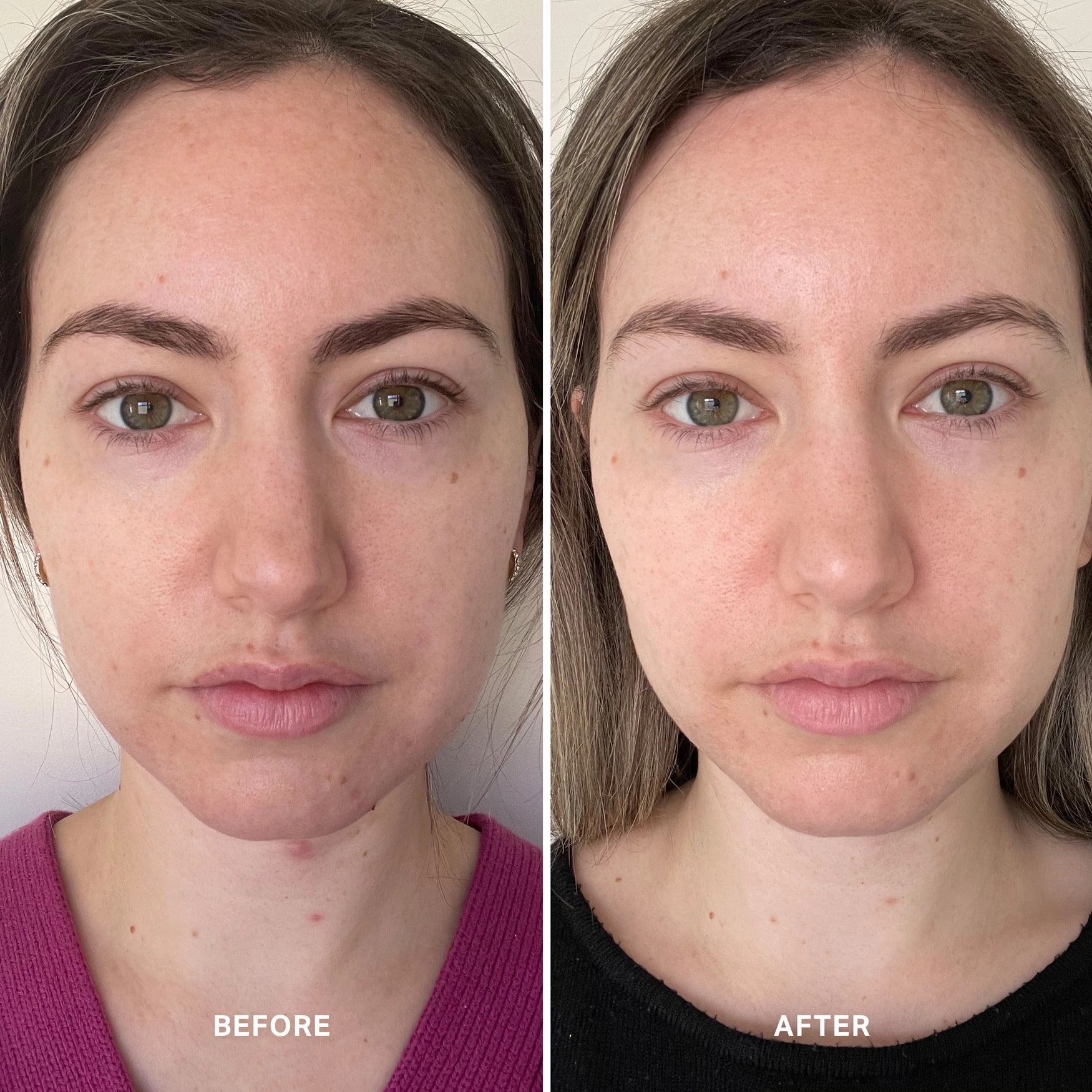 Alpha-H Vitamin B Serum with 0.5% Niacinamide 10ml