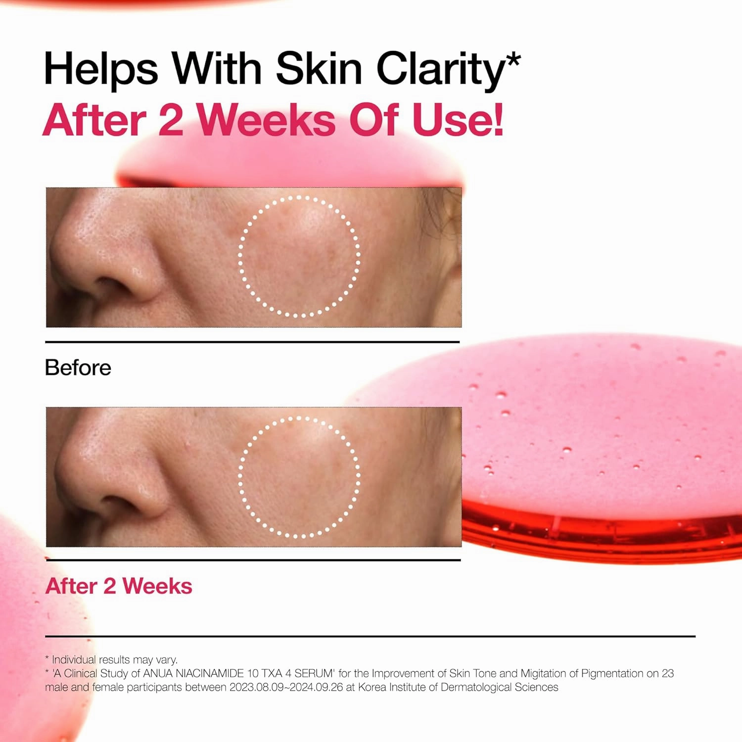 ANUA Niacinamide 10%   TXA 4% Serum