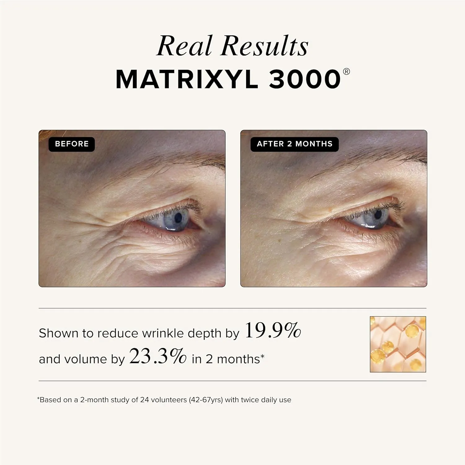Asterwood Triple Repair Matrixyl 3000   Argireline   Hyaluronic Acid   Vitamin C Serum for Face - Anti-Aging, Collagen Boosting, Hydrating - Fragrance-Free - 1 Fl Oz
