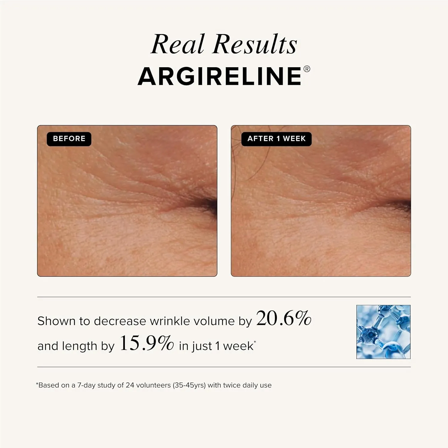 Asterwood Triple Repair Matrixyl 3000   Argireline   Hyaluronic Acid   Vitamin C Serum for Face - Anti-Aging, Collagen Boosting, Hydrating - Fragrance-Free - 1 Fl Oz