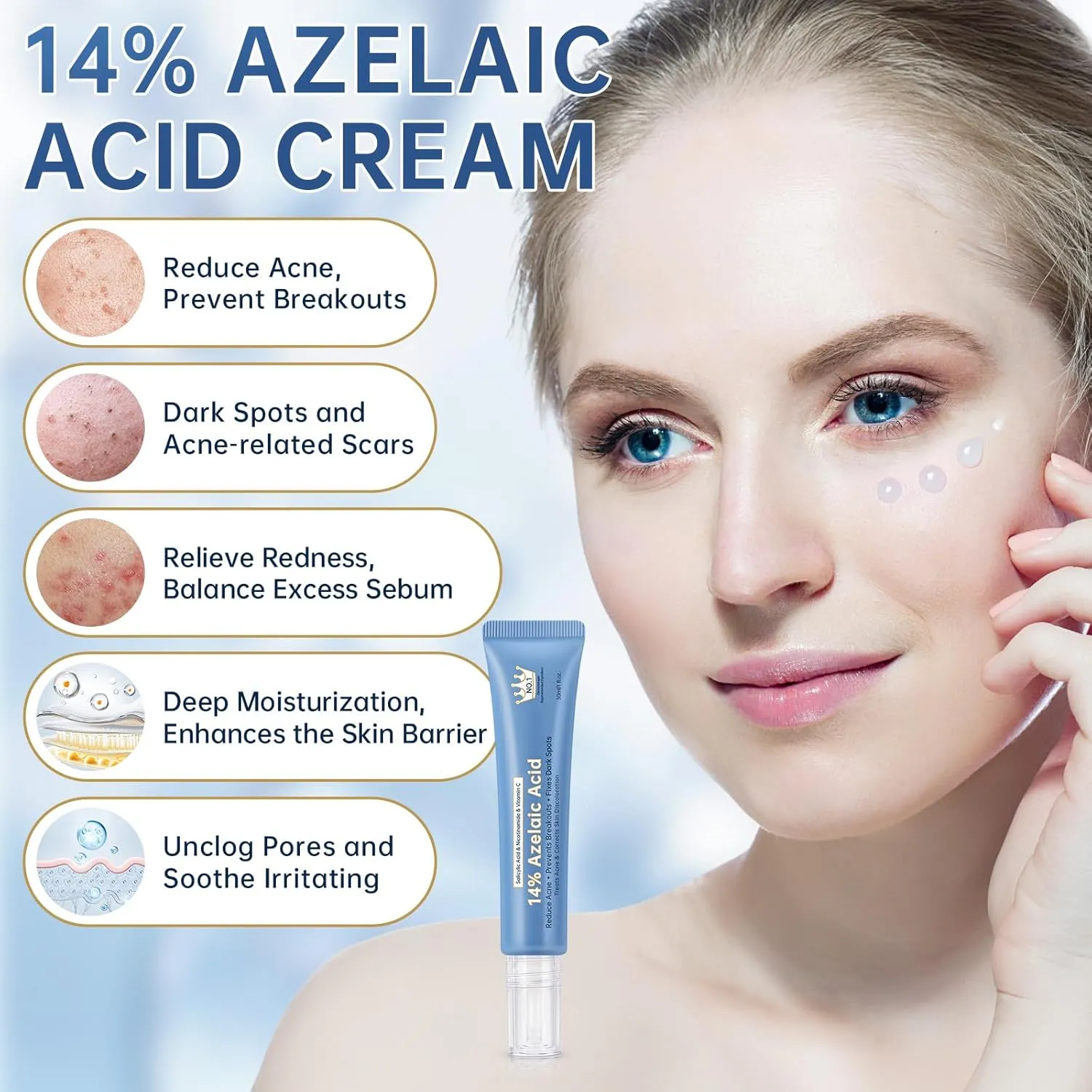 Azelaic Acid 14% Acne Cream for Redness Relief, Dark Spots, Facial Serum with Niacinamide & Vitamin C Prevent Acne Breakouts, Azelaic Acid Serum for Balance Excess Sebum & Soothe Irritation, 2 Oz.