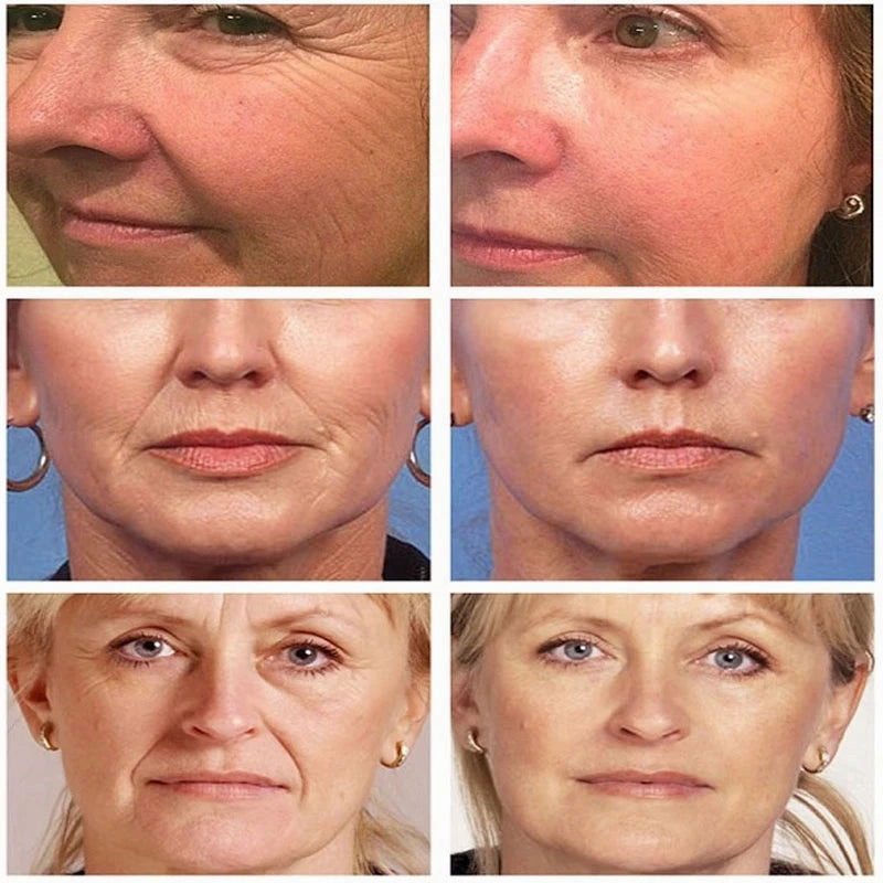 B3 Peptide Wrinkle Removal Serum
