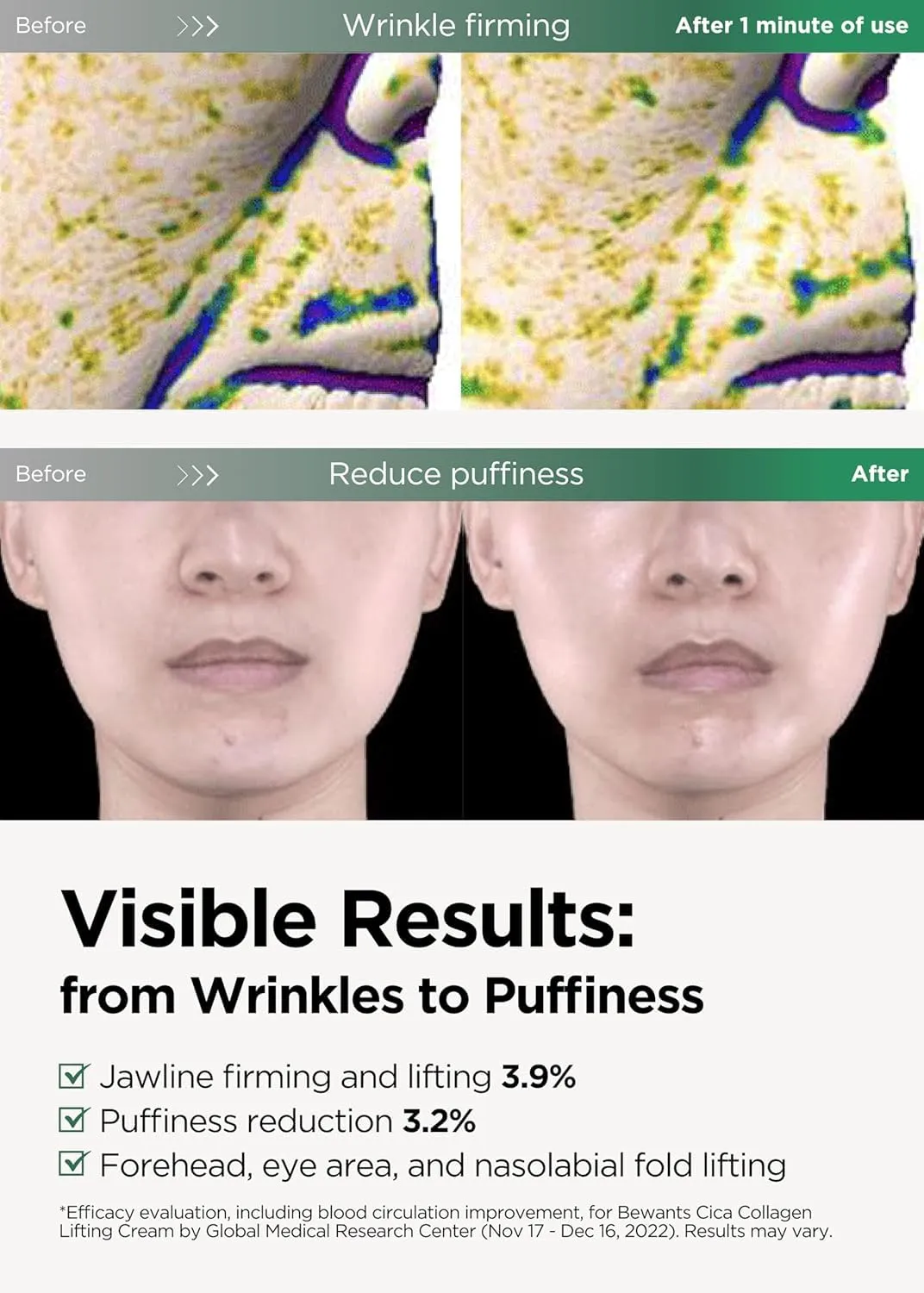 Bewants Guasha Neck Cream, Lifting & Firming Moisturizer with Centella Asiatica & Vegan Hyaluronic Acid – Includes RABIE Rabbit Edition with Smartphone Grip (1 Pack)