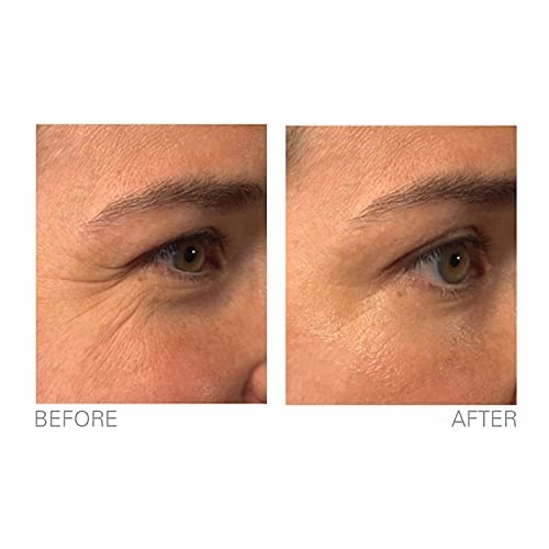 BioLogic Solutions LifTight Instant Face Lift Serum, Skin Tightening Serum for Face & Instant Eye Lift, Reduce Appearance Of Wrinkles, Sagging Skin, Crow's Feet & Fine Lines In Minutes, 0.5 Fl Oz