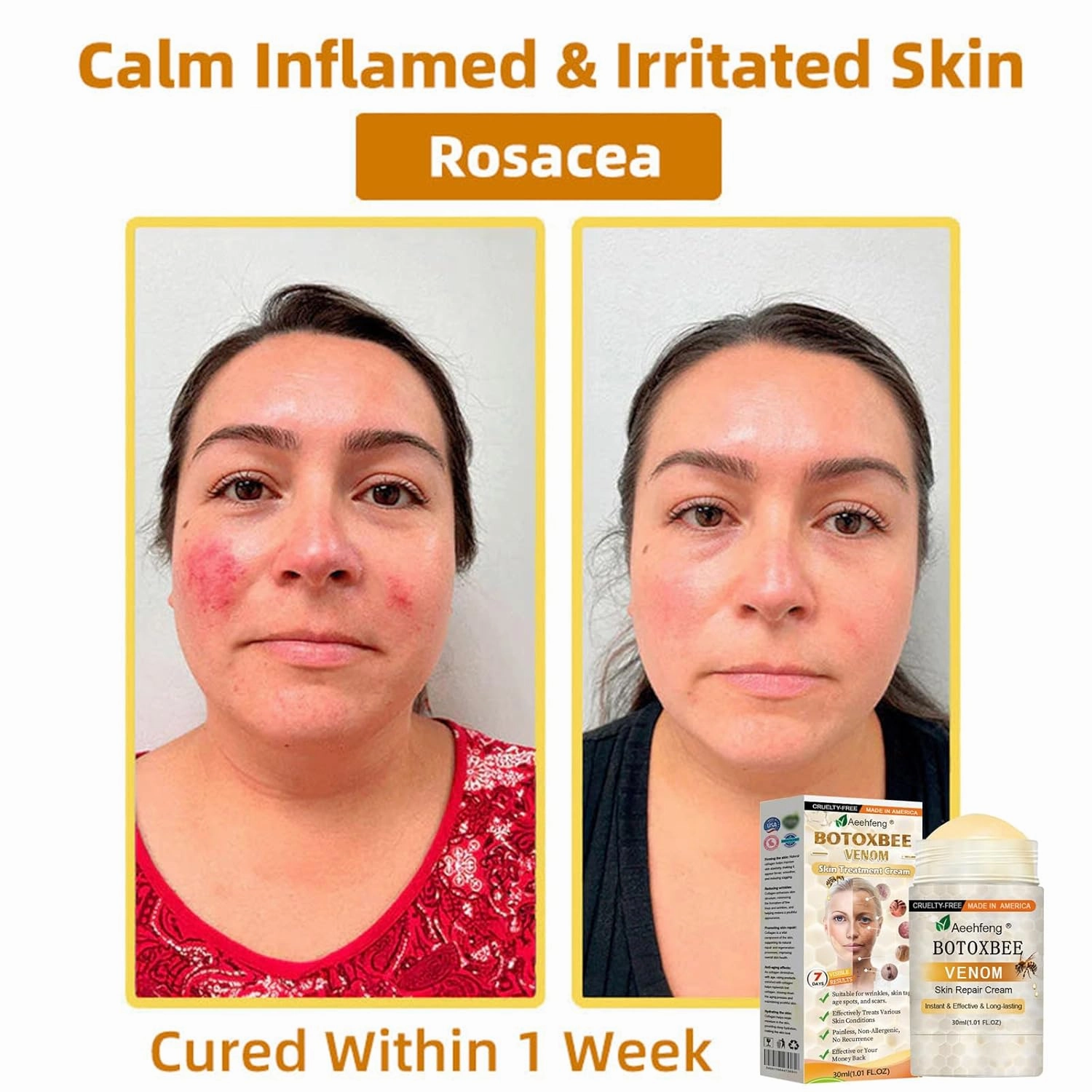 BOTOX Bee Venom Skin Repair Cream, Advanced Botox Bee Venom Firming Serum Stick, Firming & Wrinkle-Reducing Cream, Hydrating, Natural Ingredients Suitable for All Skin Types (3 Bottle)