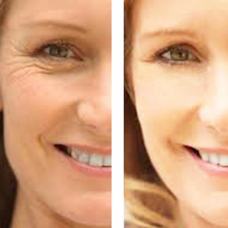C  Antioxidant Wrinkle  Reduction Serum