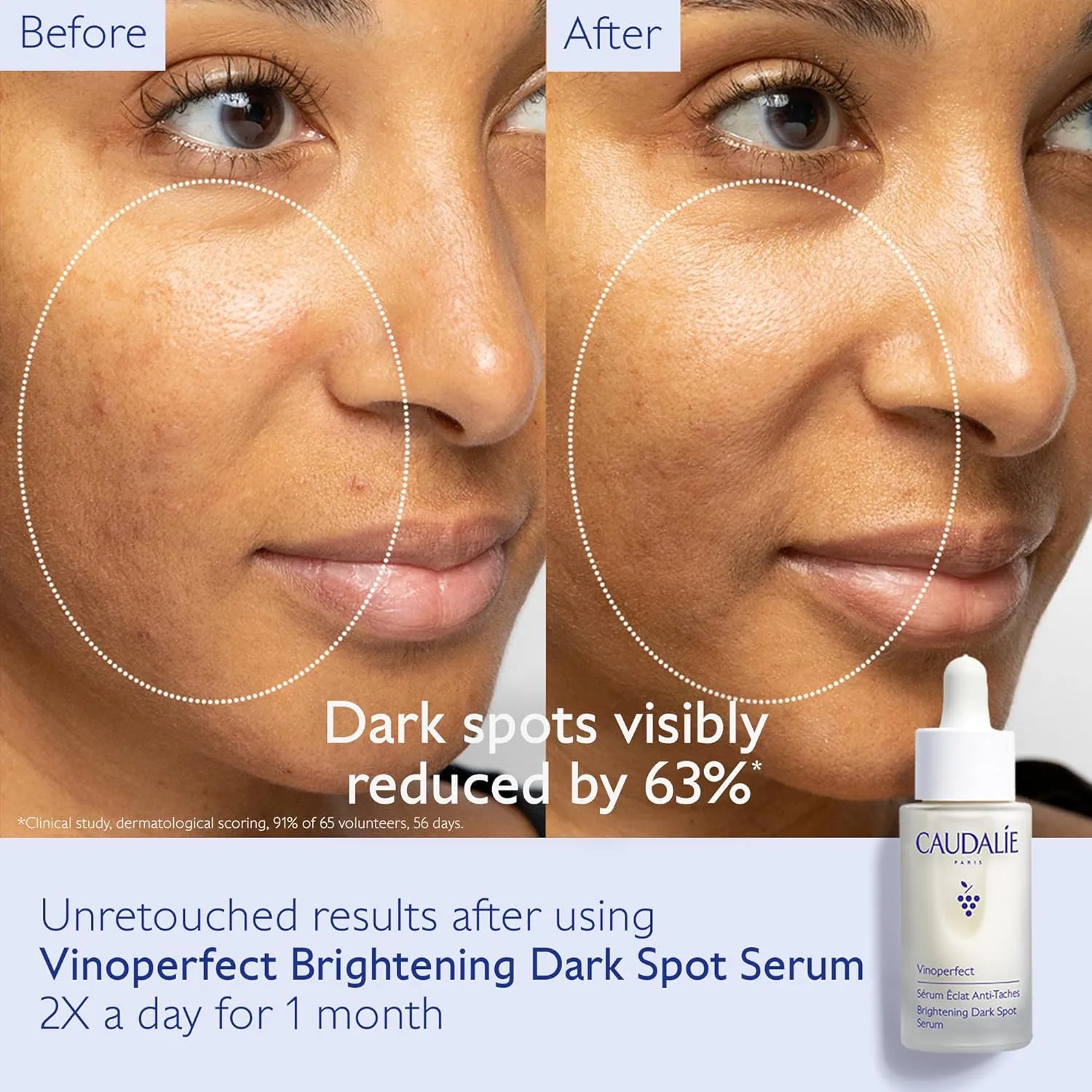 Caudalie Vinoperfect Brightening Dark Spot Serum Vitamin C Alternative - 62x More Effective than Vitamin C with Viniferine for a Visibly Brighter Even Complexion