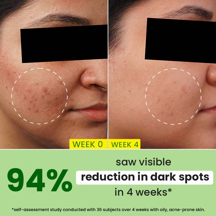 Cica   10% Niacinamide Face Serum for Oily Skin