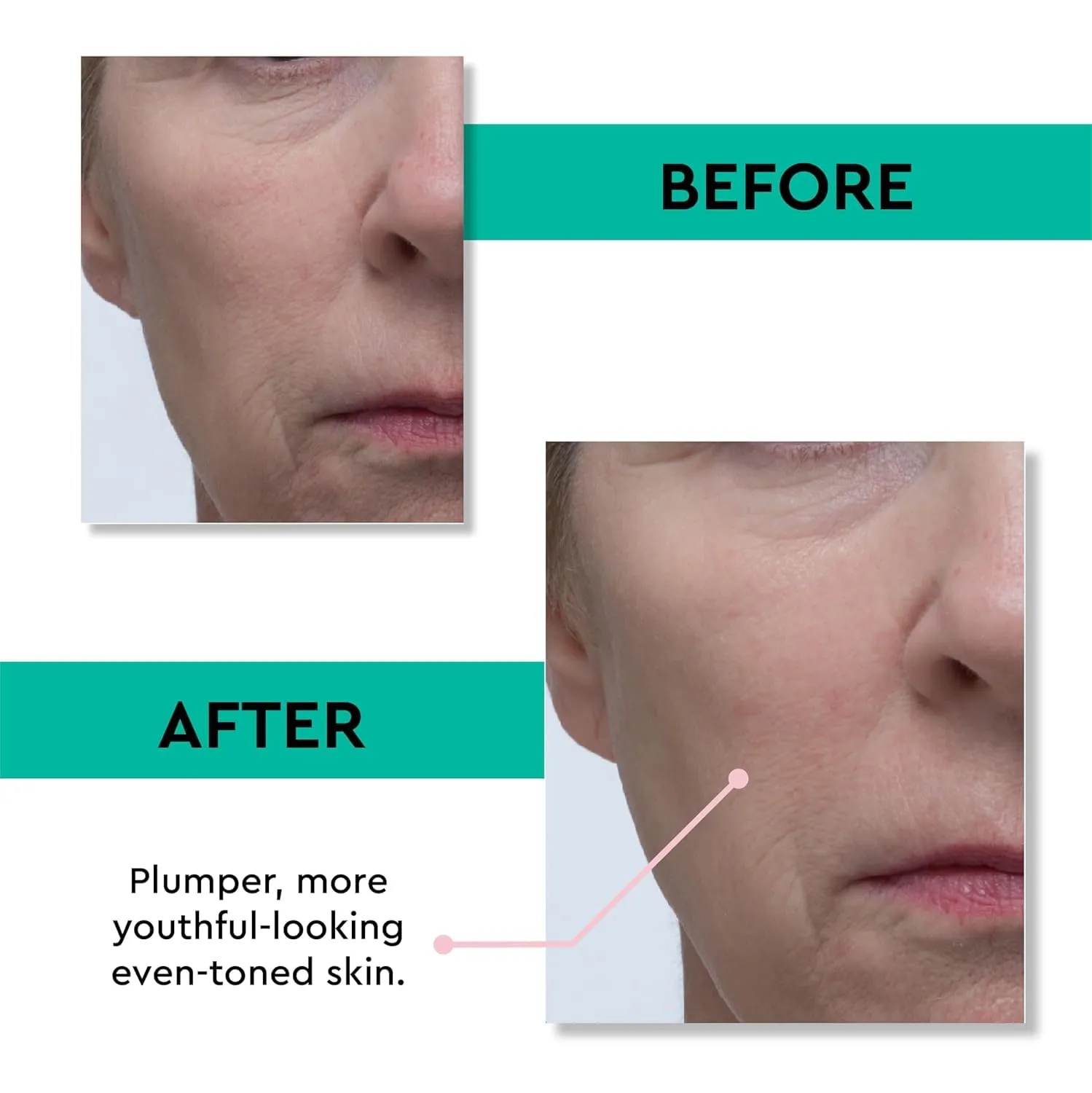 Clark's Botanicals Retinol Rescue Overnight Cream: Hyaluronic Acid & Patented Vitamin C, All Skin Types, Patented Time-Release Retinol, 30ml | 1oz