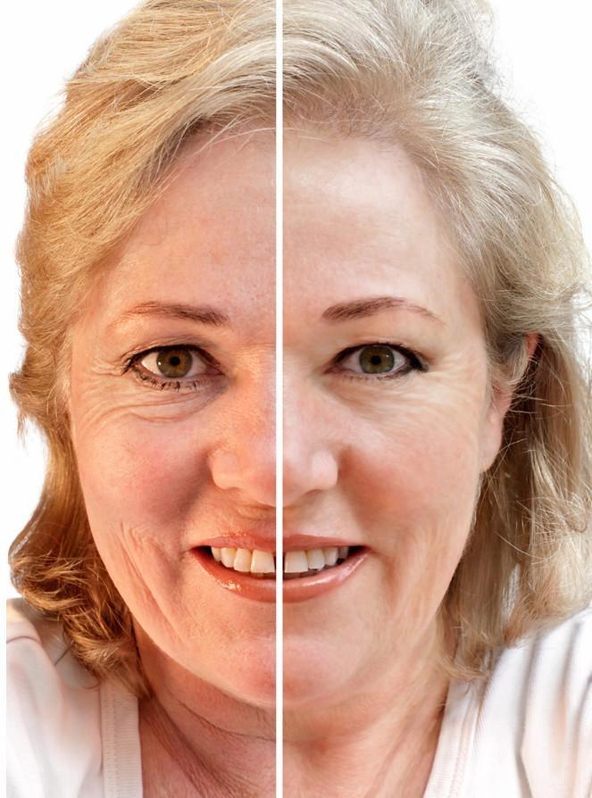 Collagen Radiance Treatment Set