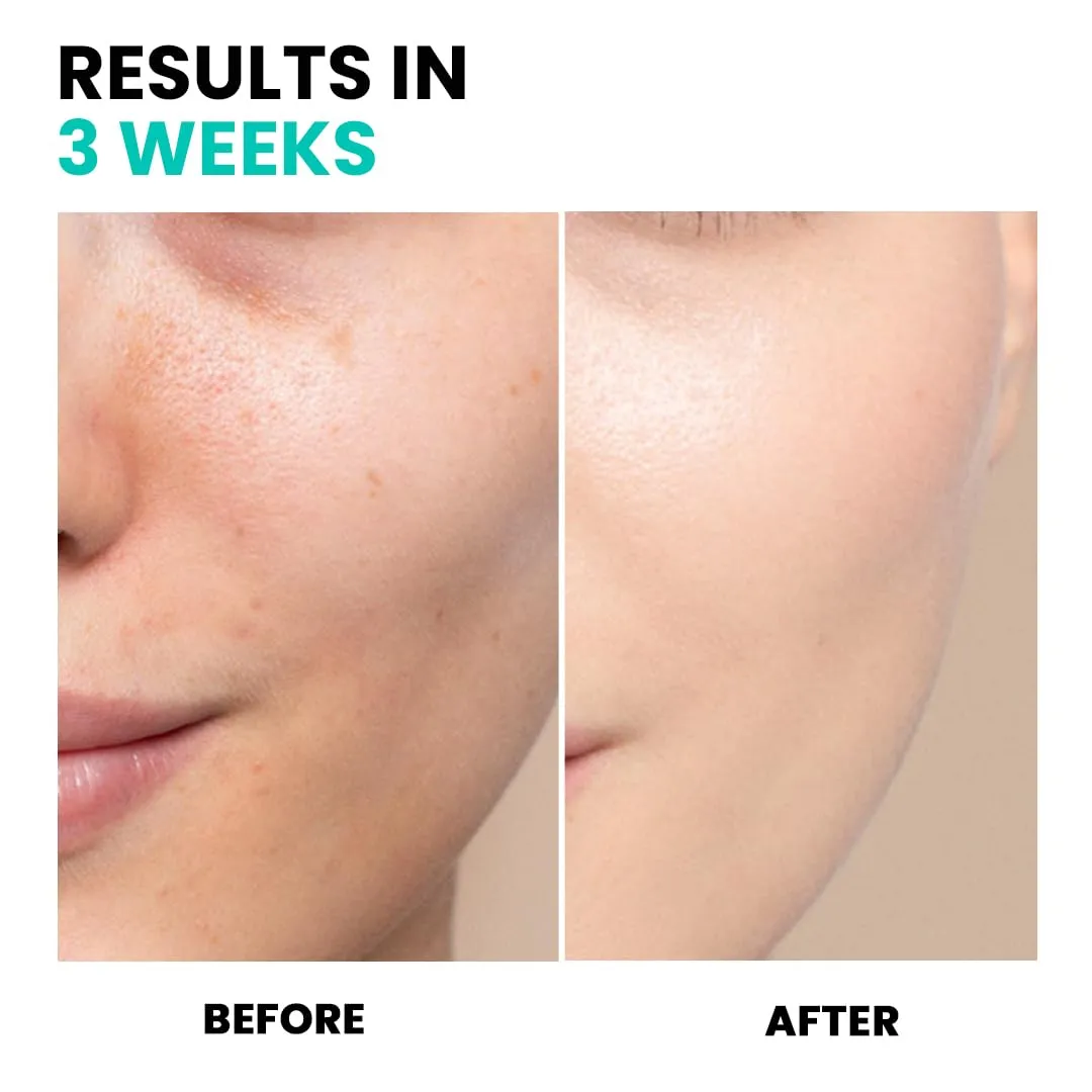 Conatural Brightening Serum 30ml - Radiant Face Serum, Daily Hydration, Antioxidant-Infused for Luminous Complexion, Water-Based Facial Serum for Radiance