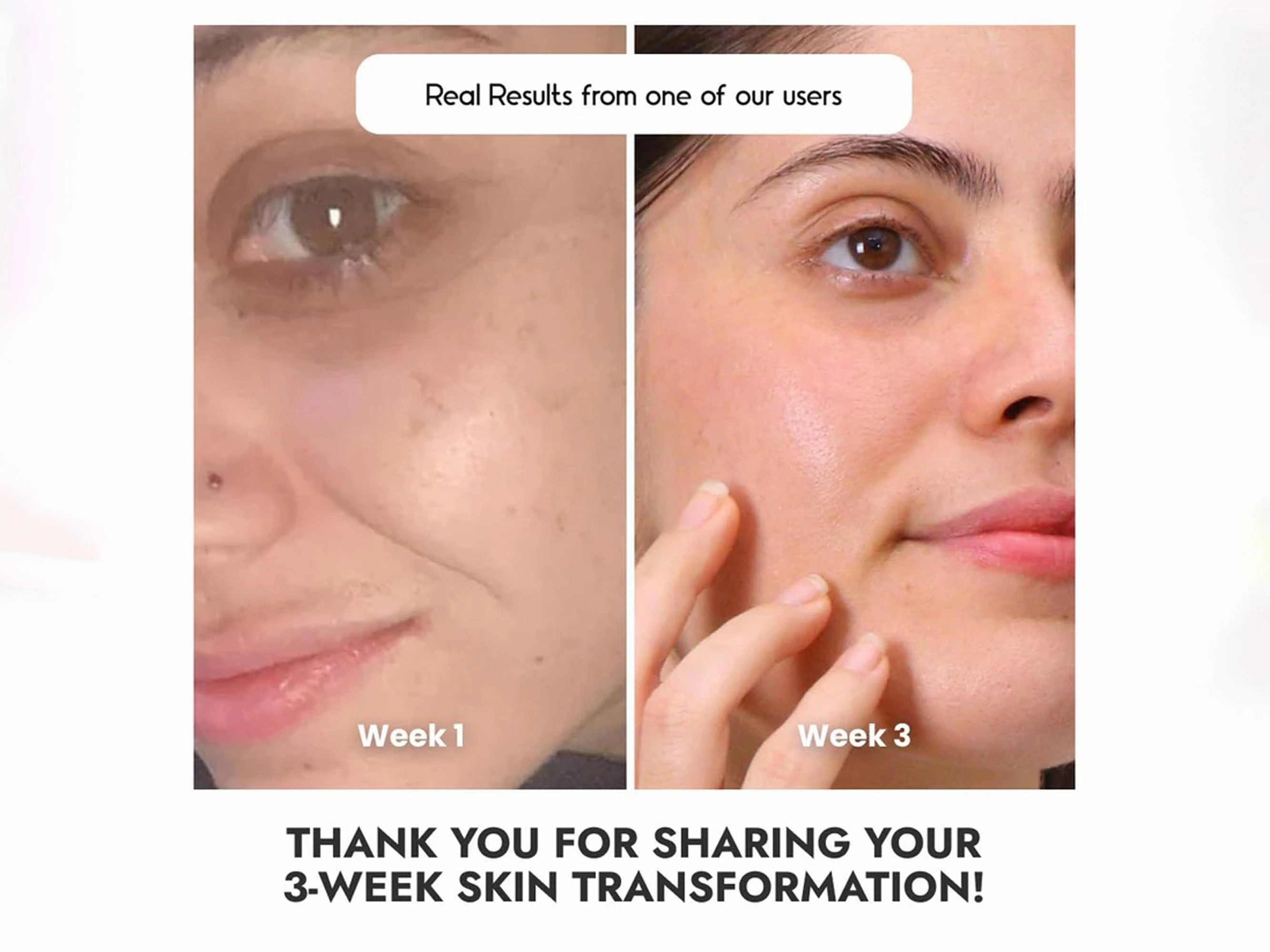 CosiQ Vitamin C-8% Ethylated Ascorbic Acid Face Serum