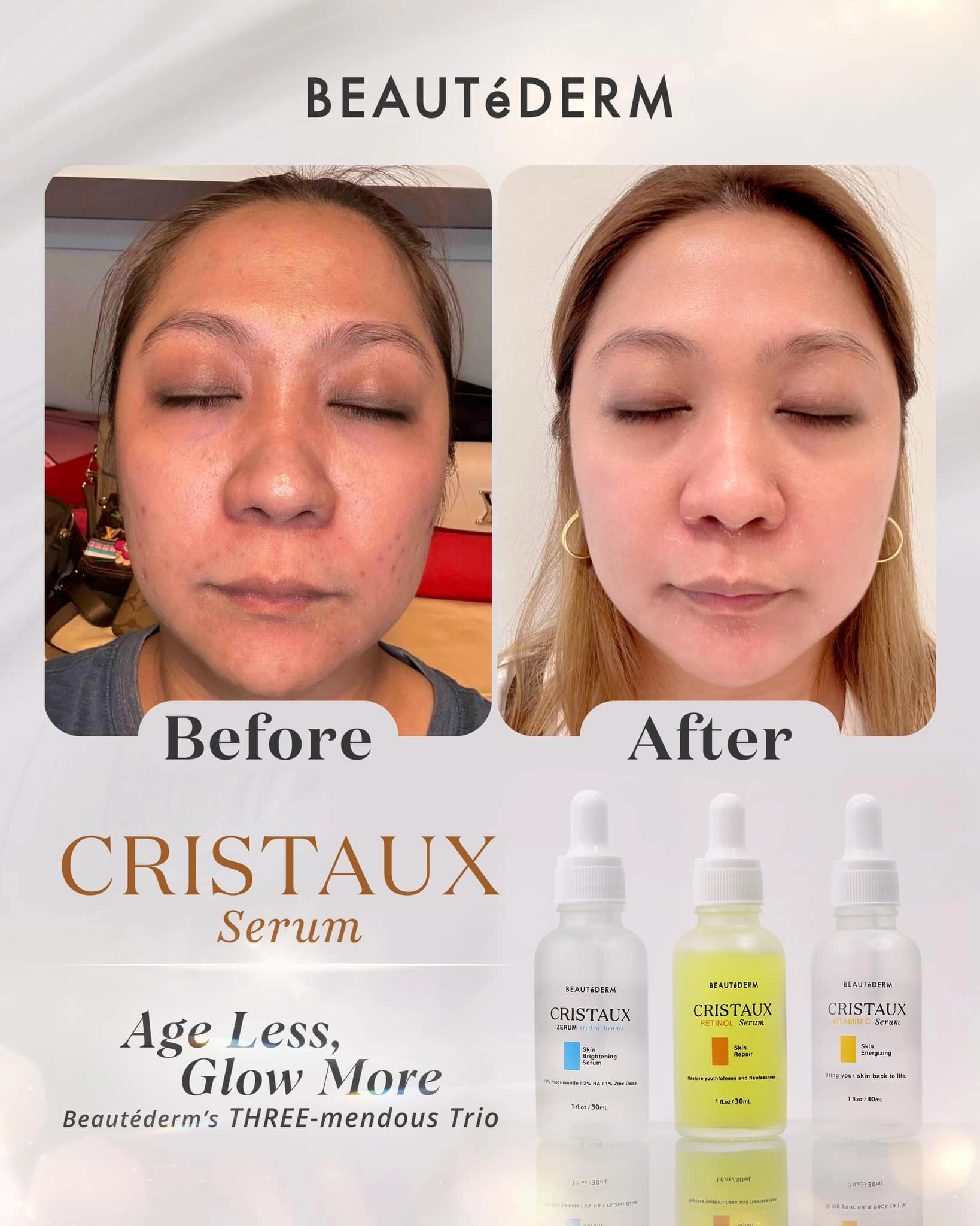 Cristaux Zerum Hydra-Beauty Skin Brightening Serum 30ml Free Night Cream 1 (20g)