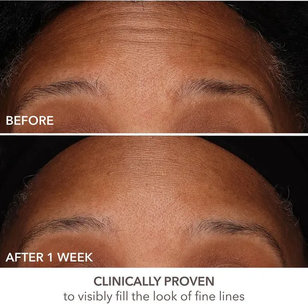 DermInfusions™ Fill   Repair Serum