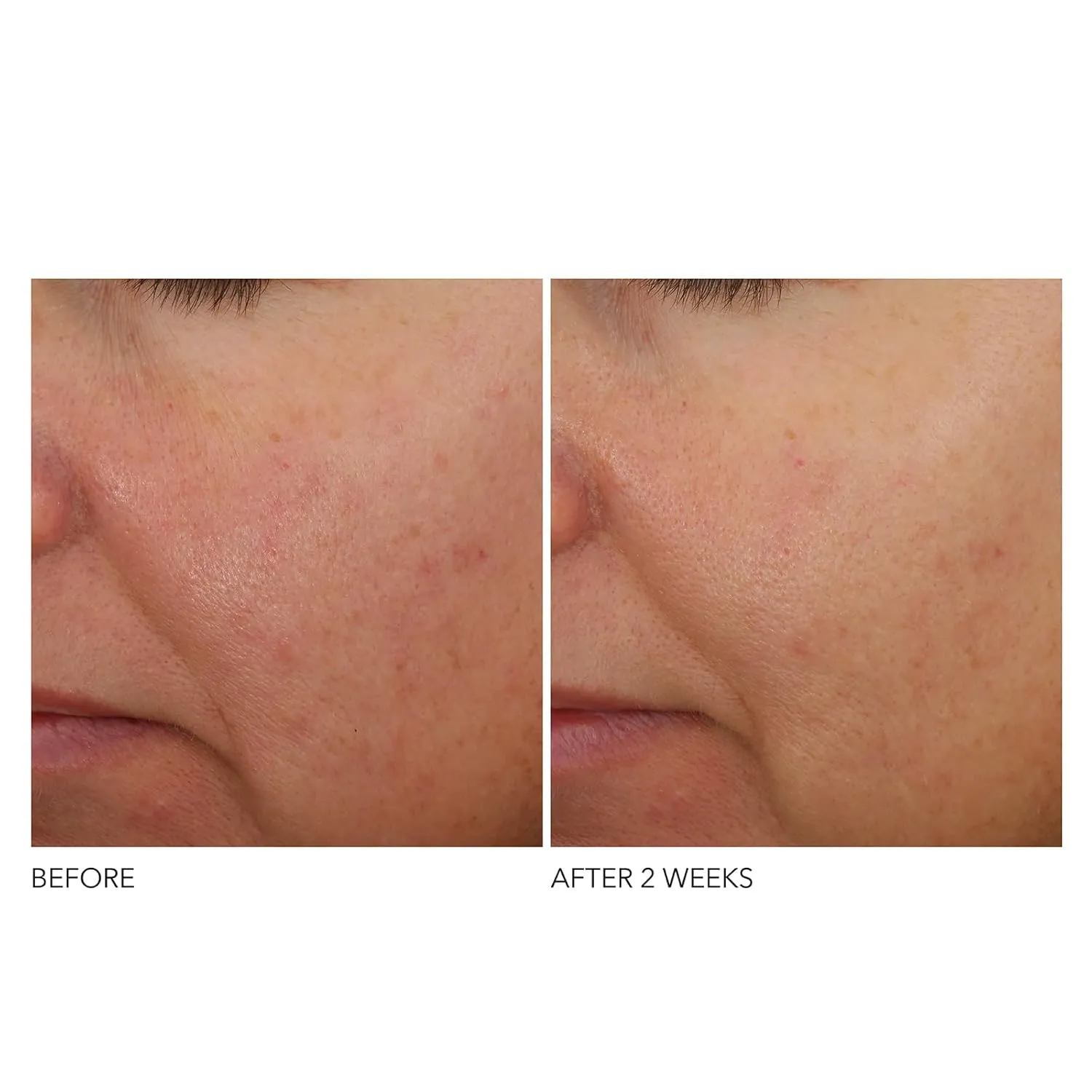 Dr Dennis Gross Advanced Retinol   Ferulic Overnight Wrinkle Treatment: Visibly Firm, Restore Hydration & Reduce the Look of Wrinkles, 1 oz