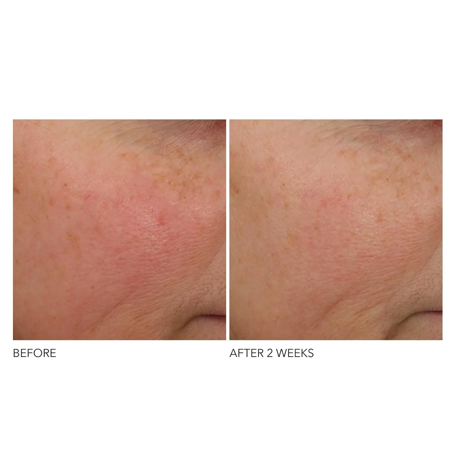 Dr Dennis Gross Advanced Retinol   Ferulic Overnight Wrinkle Treatment: Visibly Firm, Restore Hydration & Reduce the Look of Wrinkles, 1 oz
