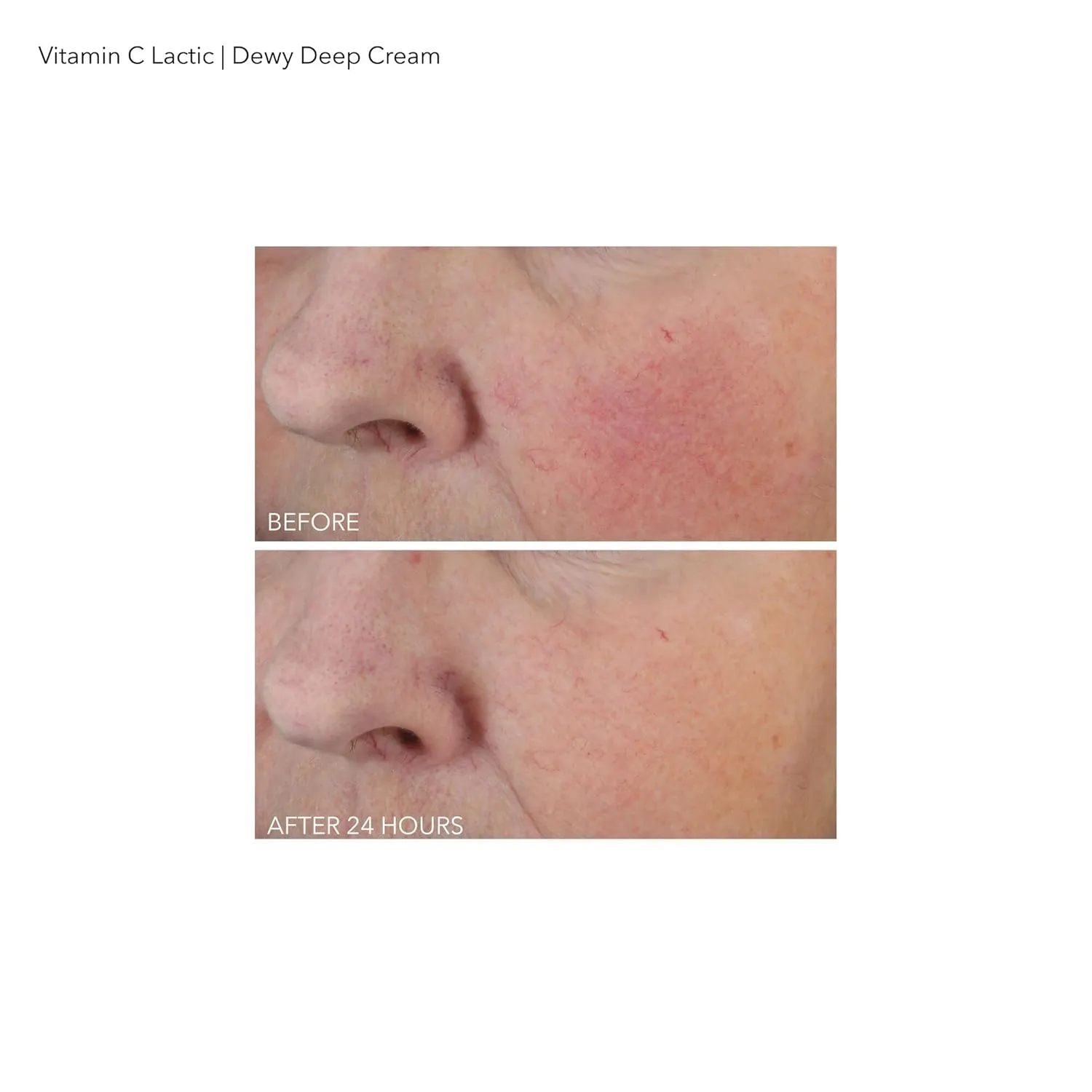Dr Dennis Gross Vitamin C Lactic Dewy Deep Cream: Ultra-Rich, Replenishing Cream for a Dewy Finish, 2 oz