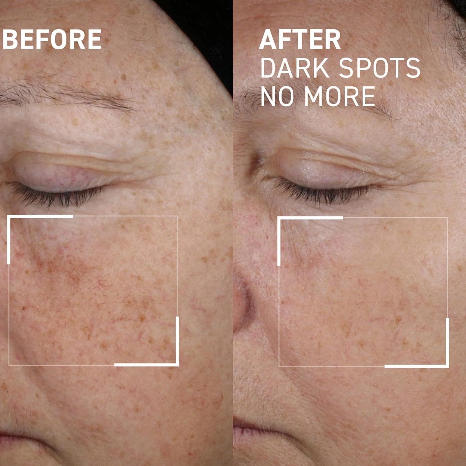 Dr. Brandt Bright This Way Dark Spots No More - 0.5 fl oz, Pack of 2 - Reduces Number, Intensity & Size of Pigmented Spots