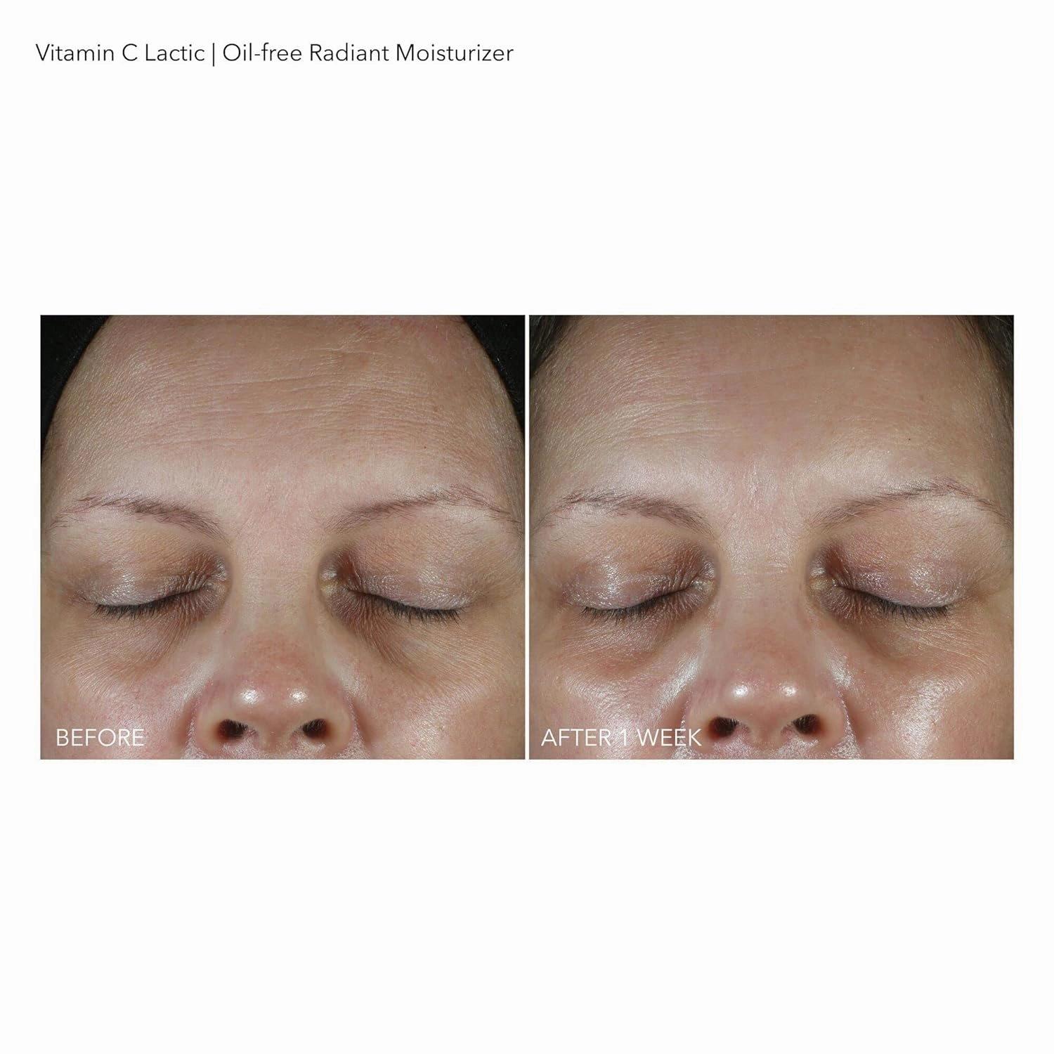 Dr Dennis Gross Vitamin C Lactic Oil-Free Radiant Moisturizer: For Dullness, Uneven Tone & Texture, Fine Lines and Occasional Dryness, 1.7 oz