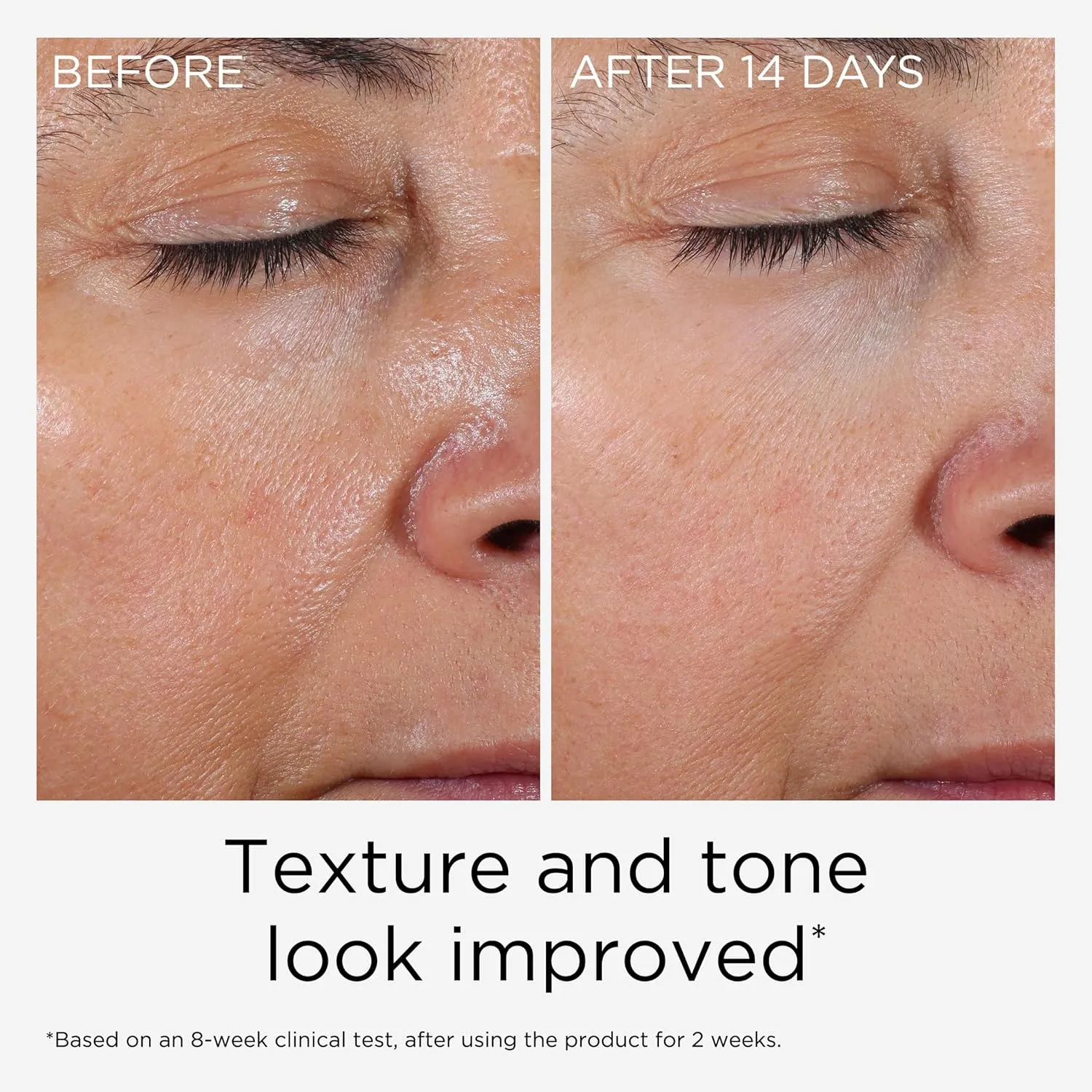 Elizabeth Arden PREVAGE Anti-Aging Face Serum 2.0 for Women, Brightening & Dark Spot Correcting Skincare, With Antioxidant Idebenone Technology