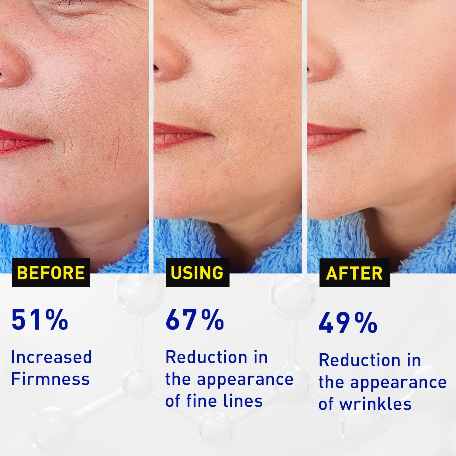 Enaskin Naturals Vitamin C Face Serum for Women - Skin Care for Dark Spots, with Hyaluronic Acid, Ferulic Acid, & Vit E - Anti Aging and Skin Brightening, Pure Vit C Facial Care