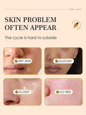 Exquisite Skin Brightening - 23% Vitamin C Serum - Hyaluronic Acid - Vitamin E - Moisturizes Skin - Evens Skin Tone - Anti-Aging - Anti-Wrinkle & Skin Hydration - Antioxidant Protection