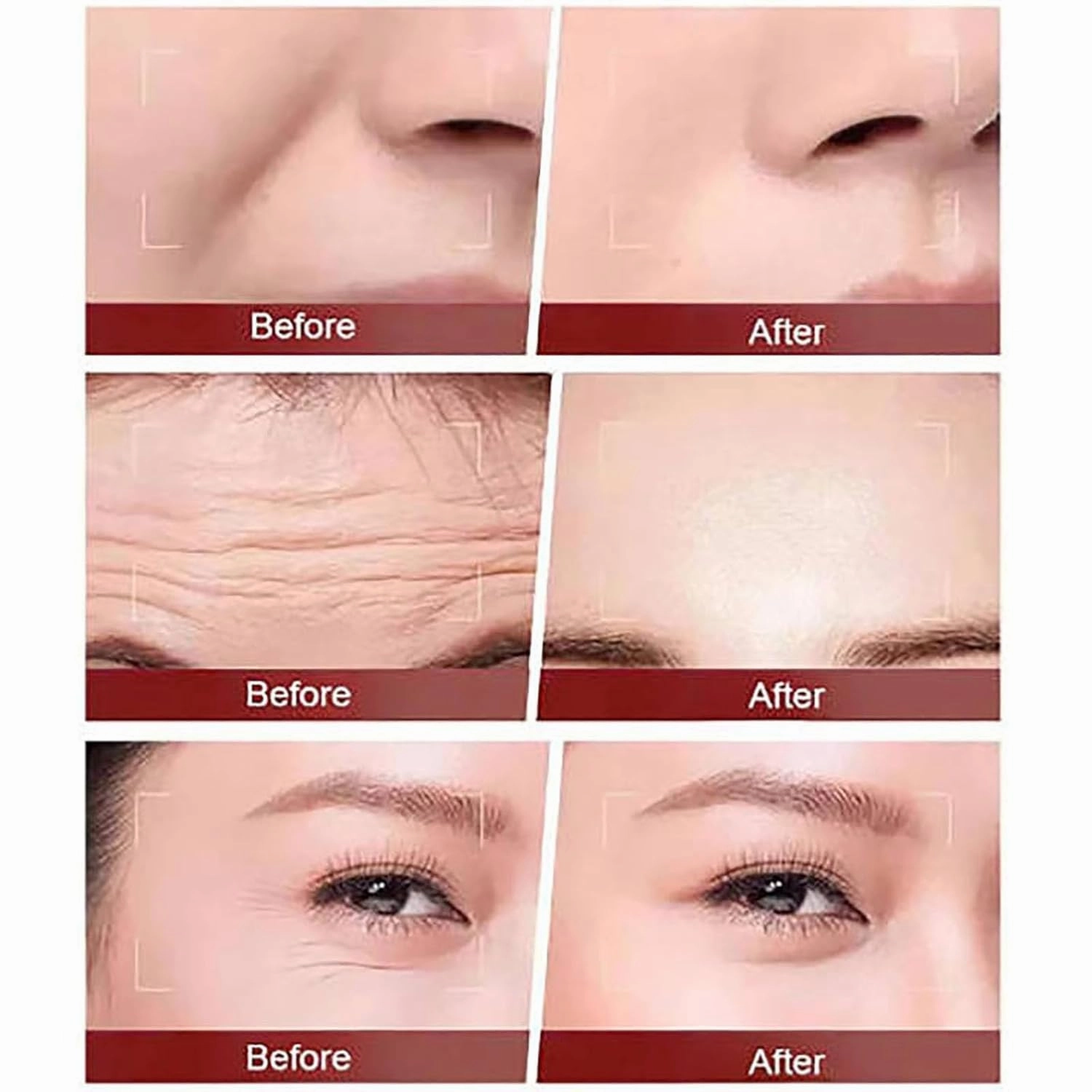 Helicopter Anti Wrinkle Serum, Humorous Anti Wrinkle Serum, Auraarena Wrinkle Cream, Anti-Aging Wrinkle Lifting & Firming Essence, Reduce Fine Lines and Wrinkles (2pcs)