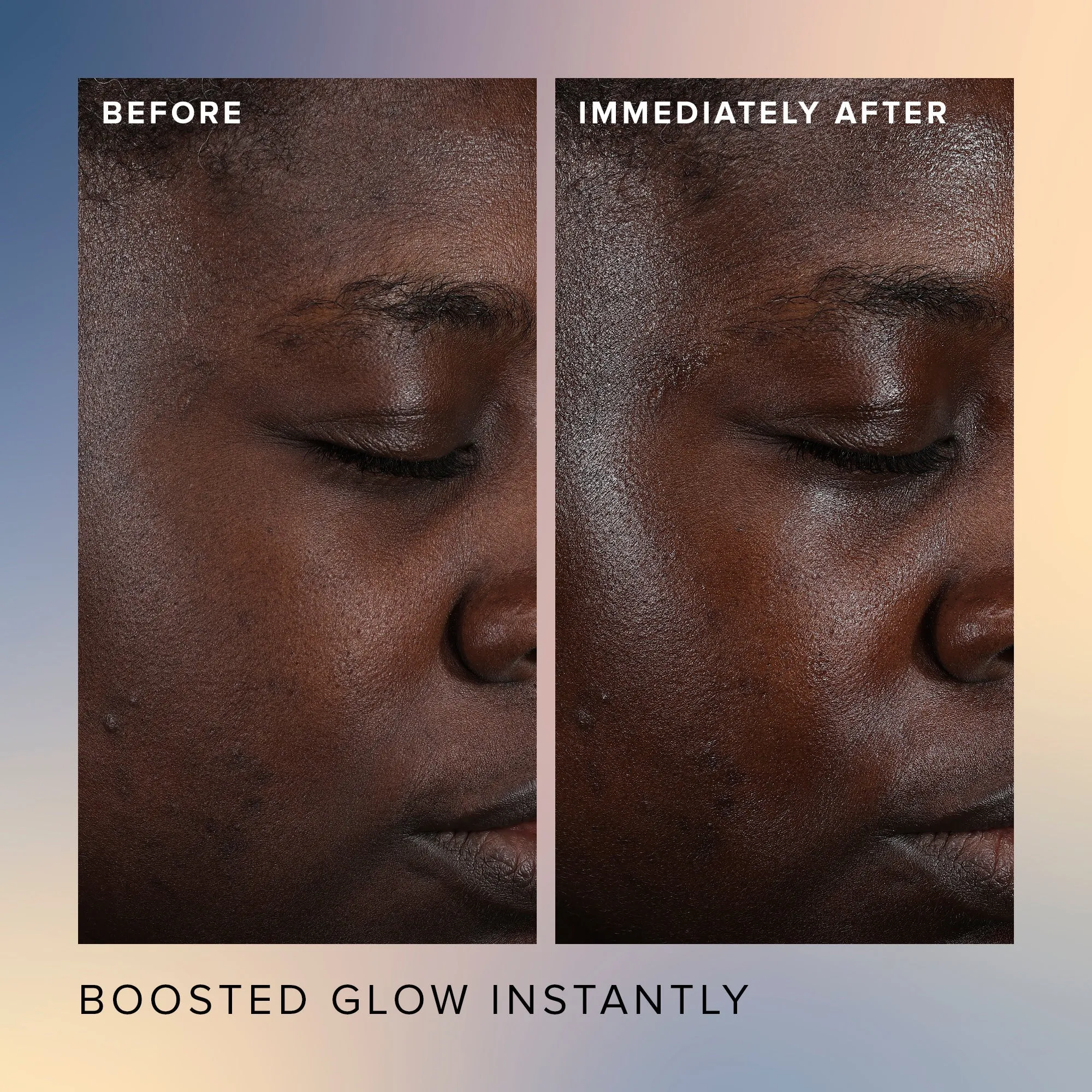 Honey Glow 17% AHA   BHA Resurfacing Acid Serum