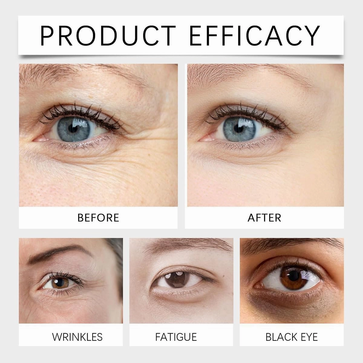 Instantaneou Lutein Eye Essence Oil, Instantaneou Lutein Eye Serum, Anti-Wrinkle Essence Oil, Improve Wrinkle, EyeBags, Dark Circles for Women and Men (1pc)