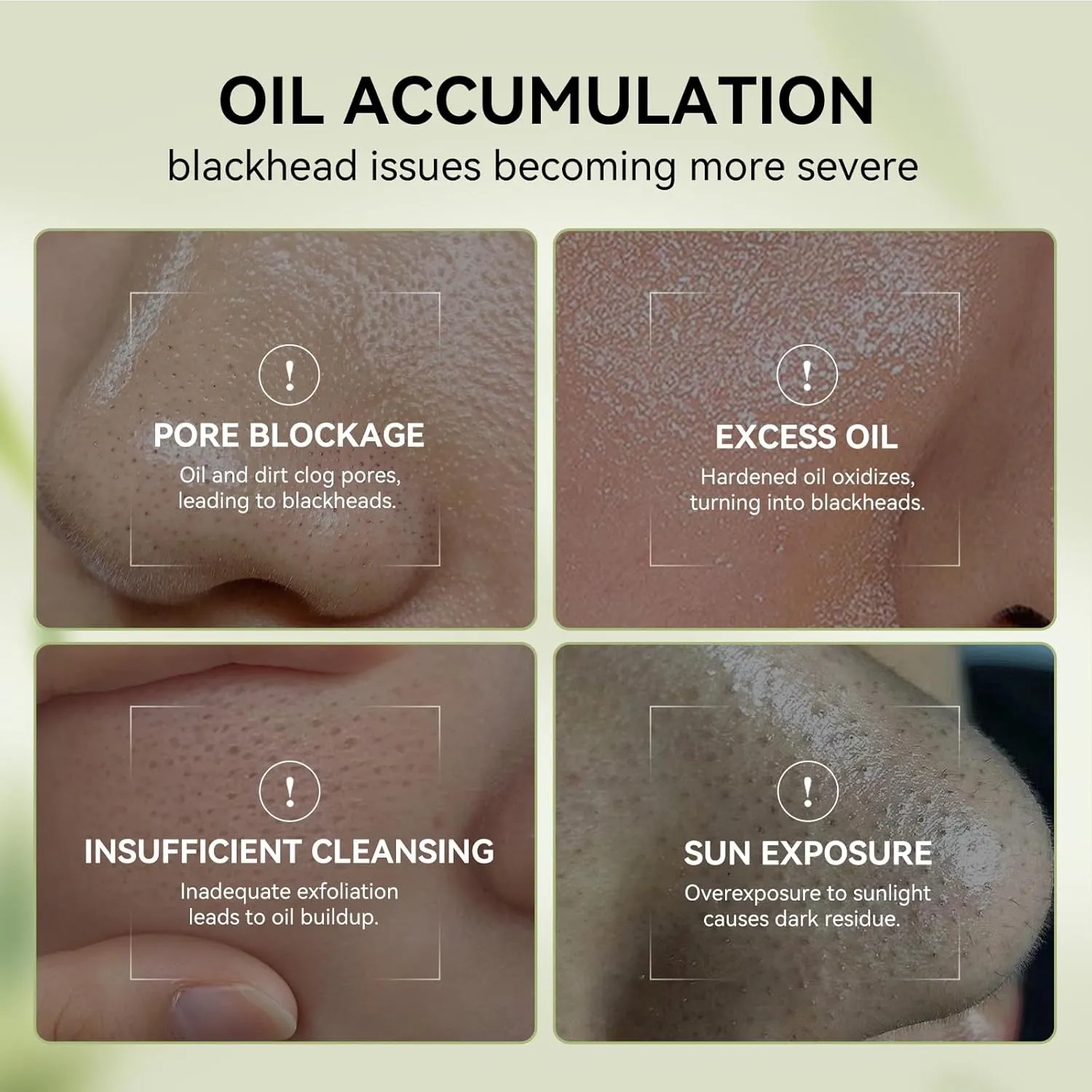 LANBENA 3-in-1 Blackhead Removal Set - Bamboo Charcoal Pore Strips (30g), Pore Minimizing Serum (30ml) & Removal Paper - Mask for Face, Minimizes Pores & Leaves Skin Fresh & Clean, Blackhead Remover