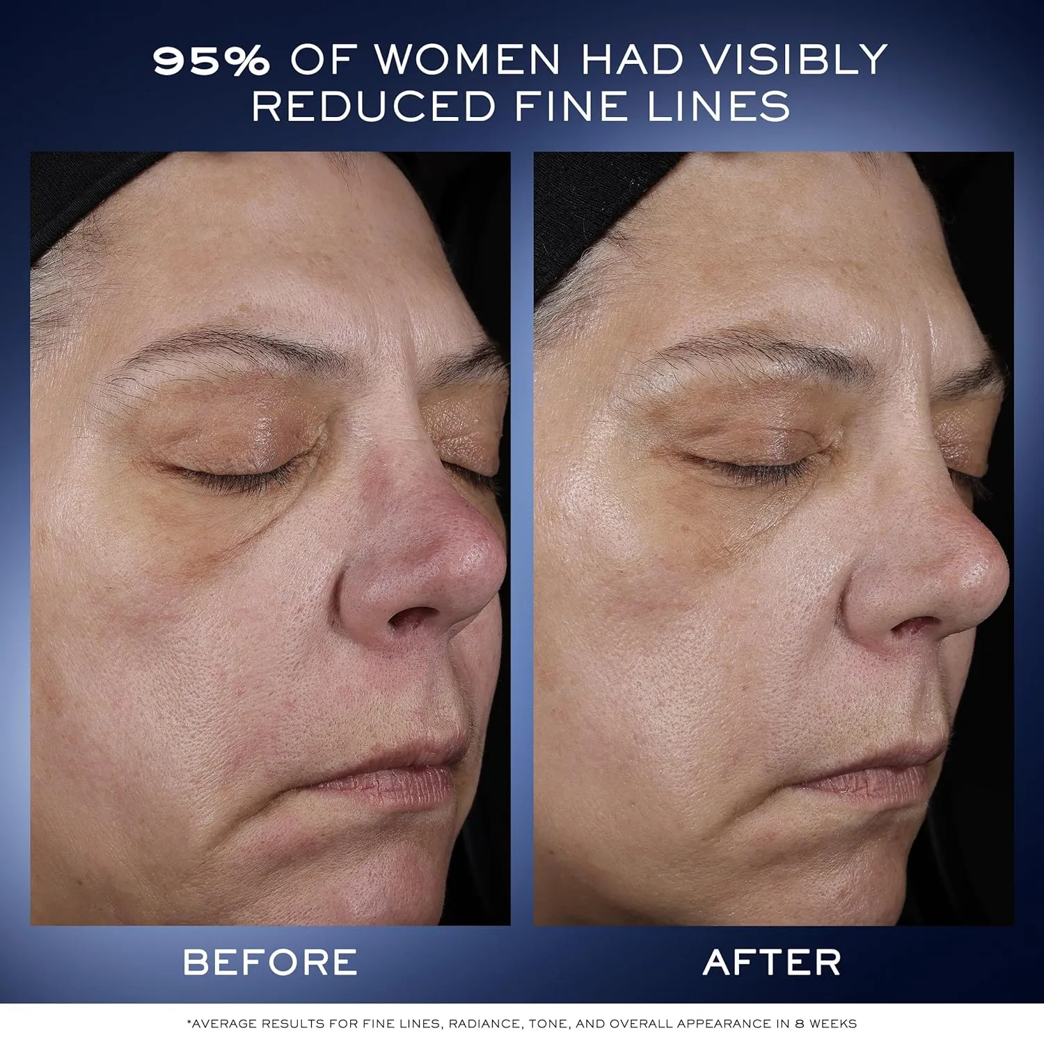 Lancôme Génifique Ultimate Dual Recovery Face Serum- Anti-Aging Serum Visibly Improves Fine Lines, Rough Texture, Plumpness and Even Skintone - with Beta Glucan and, Hyaluronic Acid
