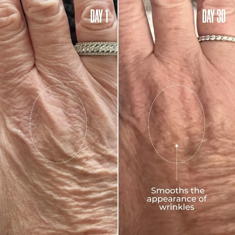 MAËLYS B-GLOSSY Smoothing Body Serum - Anti-Aging Hyaluronic Acid Serum for Body Wrinkles - Hydrating Serums with Peptides & Shea Butter To Smooth The Appearance Of Wrinkles