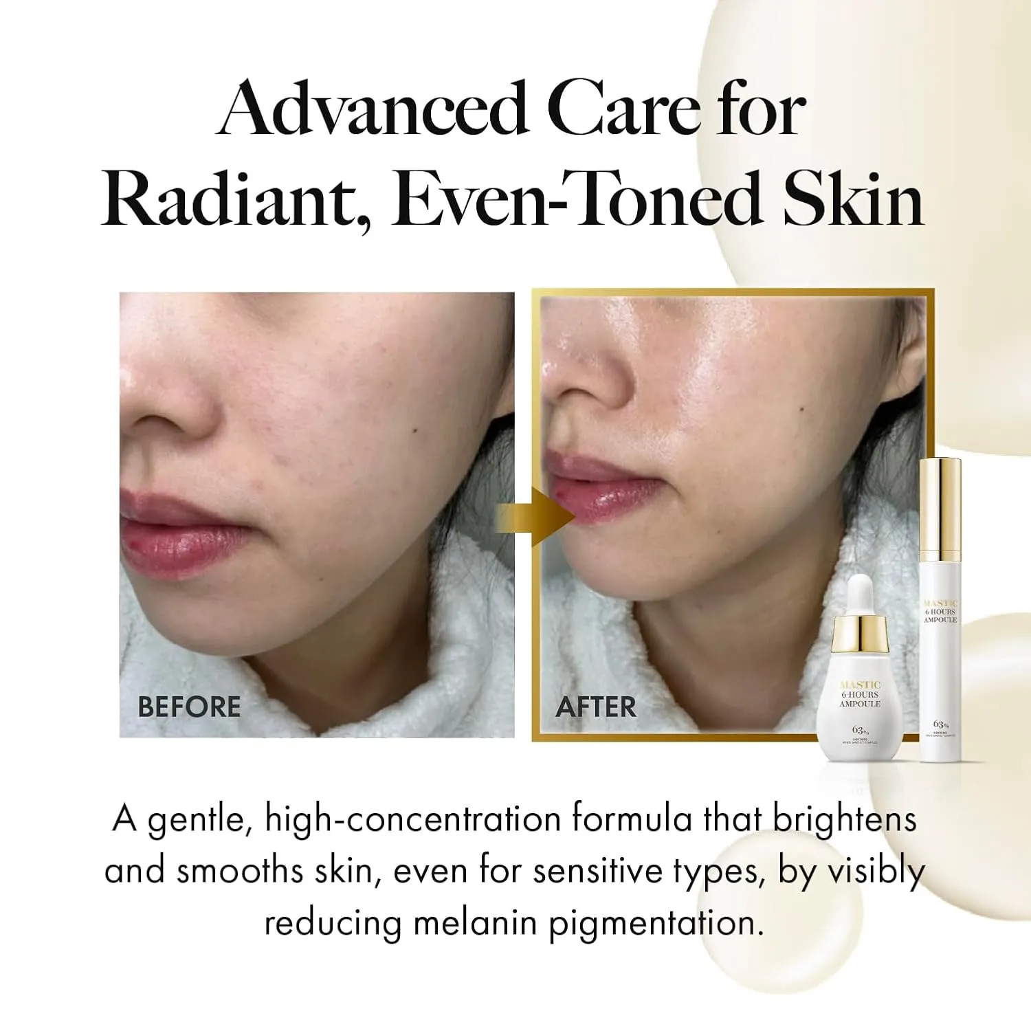 MASTINA Mastic Serum Roller - Dark Circle Remover & Eye Serum for Brighter, Firmer Under Eyes, Korean Skin Care, 0.5 fl oz,White Mastic Complex 63%   Tranexamic Acid 2%   Niacinamide 5%
