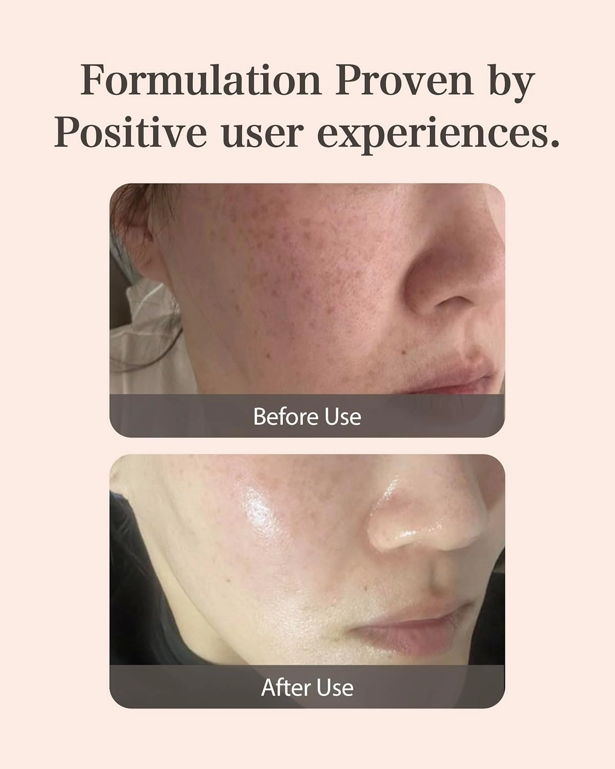 MASTINA Mastic Ampoule Serum Spoid Type Set(Dropper Type, 0.5fl oz, pack of 3), Fermented Mastic Gum. White Mastic Complex 63%   Tranexamic Acid 2%   Niacinamide 5%