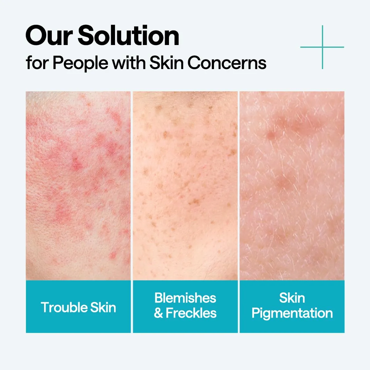 Mediheal Madecassoside Repair Serum 1.35 fl.oz - Blemish Care, Fades Pigmentation and Freckles & Skin Soothing & Hydration - with Centella Asiatica, Niacinamide
