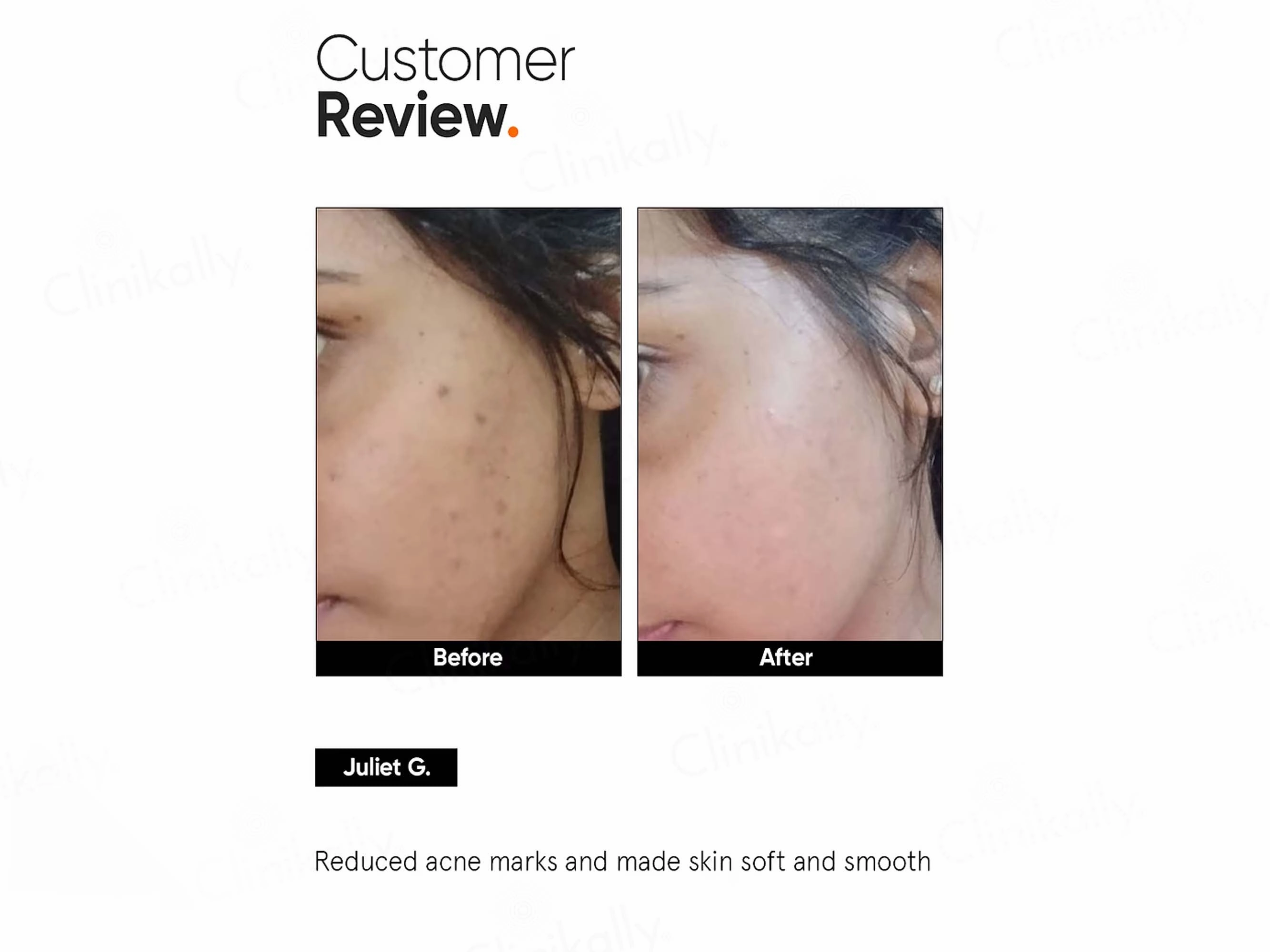 Minimalist 5% Niacinamide Face Serum