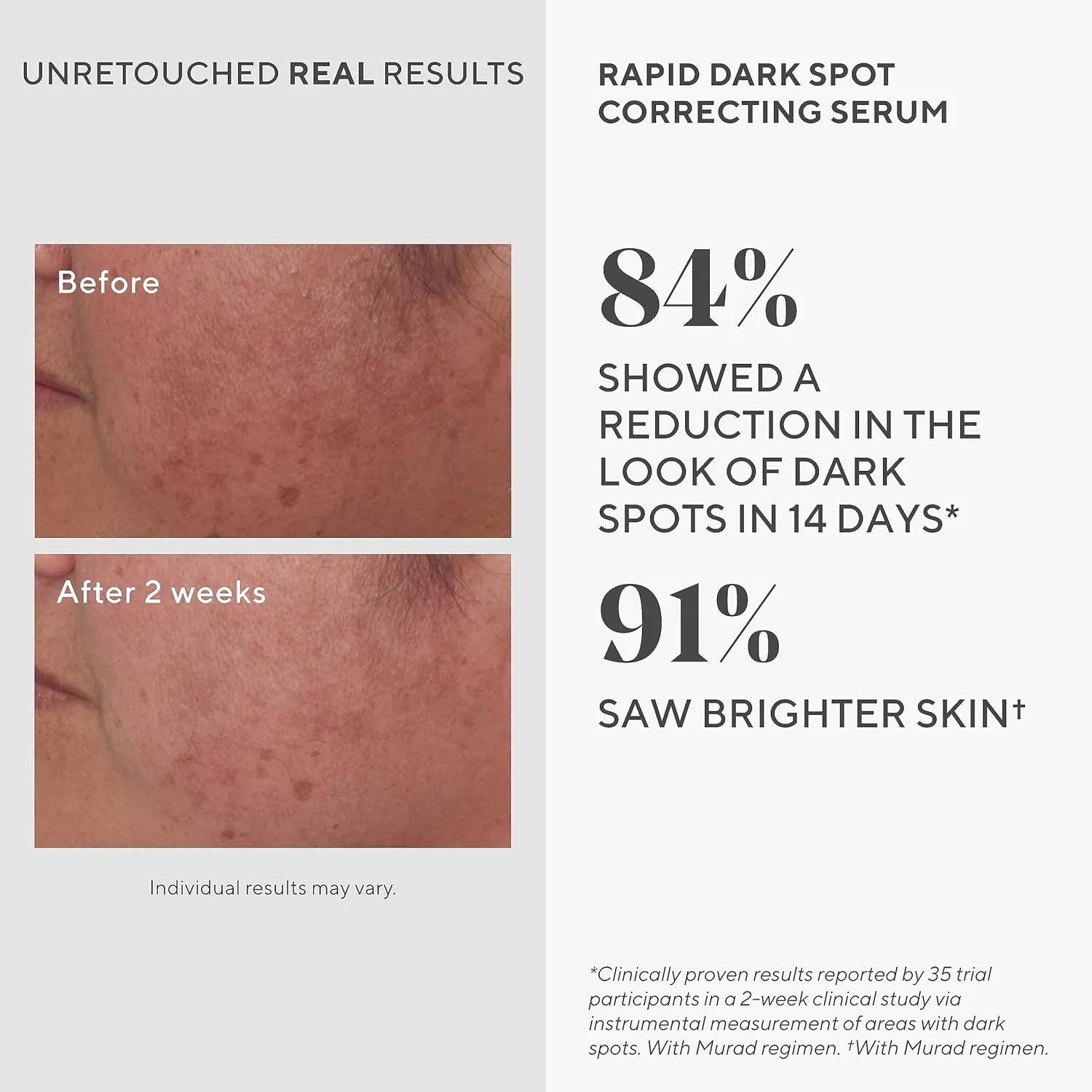Murad Rapid Dark Spot Correcting Serum - Skin Brightening Face Serum for Hyperpigmentation - Glycolic Acid Treatment Backed by Science