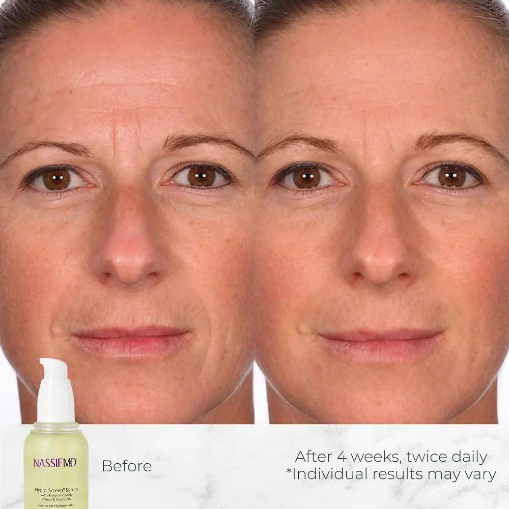 NassifMD Hydro-Screen Hydrating Serum with Hyaluronic Acid & Ceramides – Lightweight, Fast-Absorbing Formula for Smooth, Plump, Moisturized Skin – Ideal for Dry or Sensitive Skin