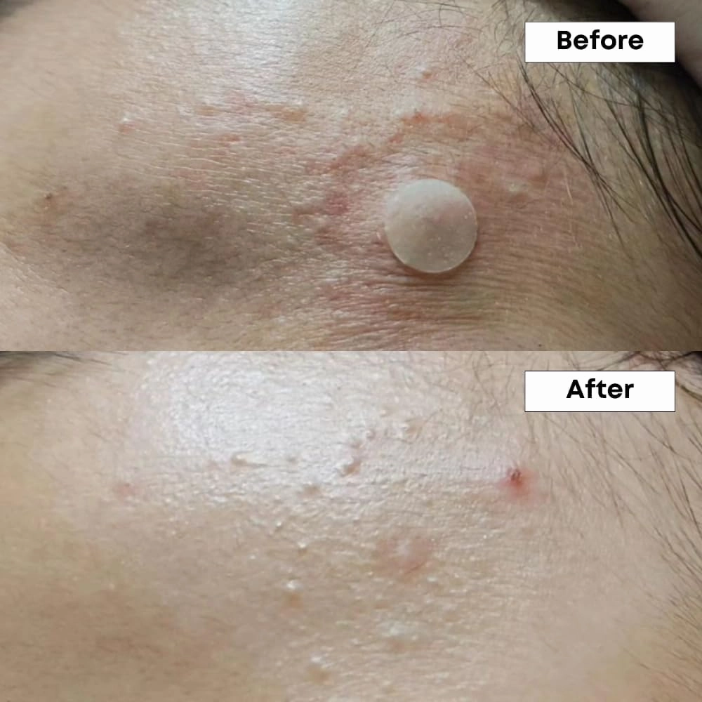 Nine less A-Control 10% Azelaic Acid Serum 30ml