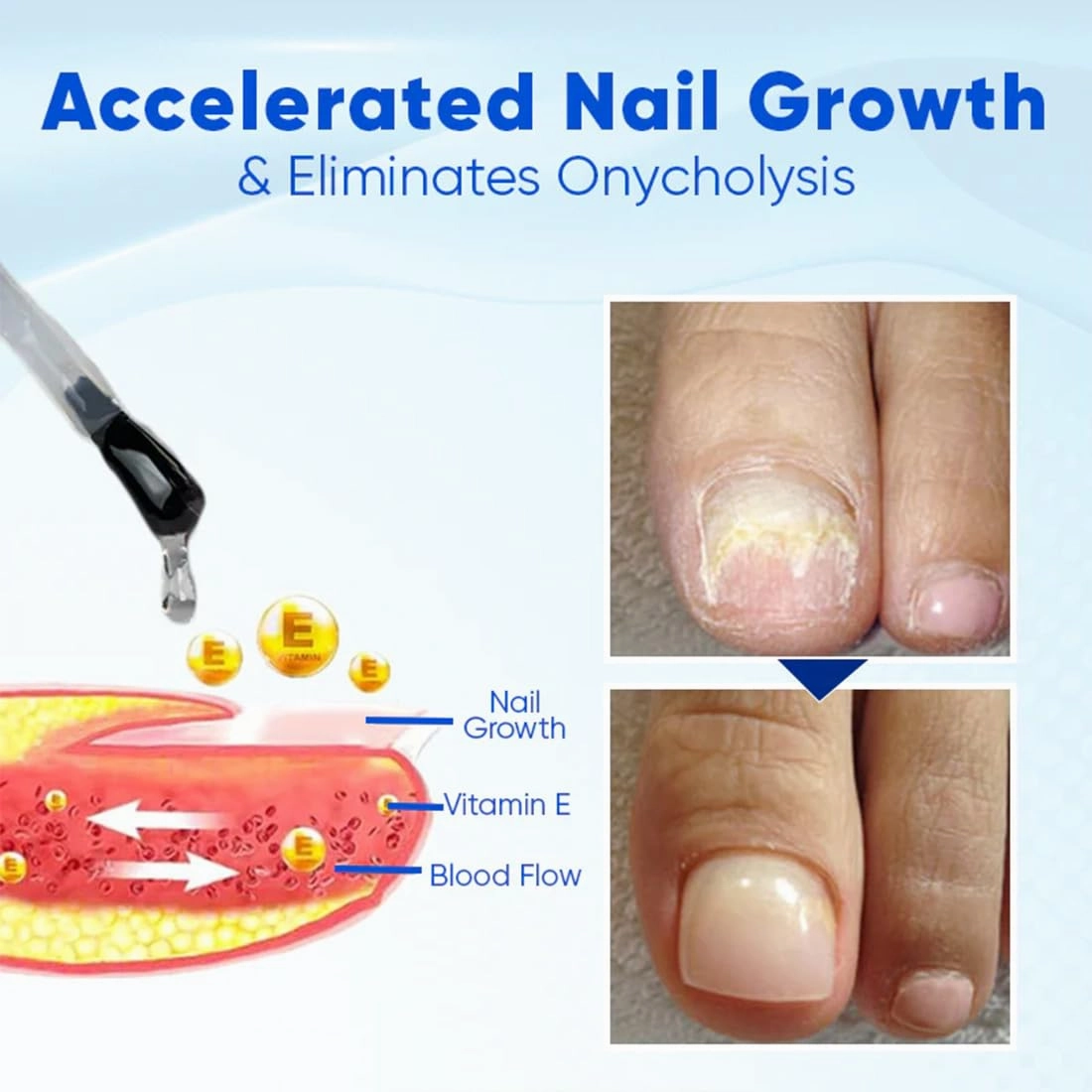 OnyxoGuard Nail Growth and Repair Serum,Nail Strengthener for Thin Nail, Brittle & Damaged Strengthener Base Coat Nail Polish Repair Nail Growth Treatment, Crystal Clear (3PCS)