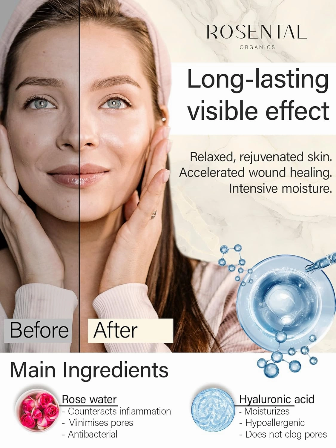 Organics Hyaluronic Serum - High Dose BIO Hyaluronic Acid - Facial Care - Moisturizer - Moisturizing Skin Care for the Face - Anti-Aging - Natural Cosmetics - Made in Germany (30ml)
