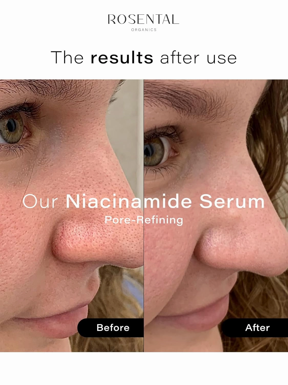 Organics Hydrating Facial Serum - 100% Vegan & Natural Cosmetics (30 ml, Niacinamide Serum)