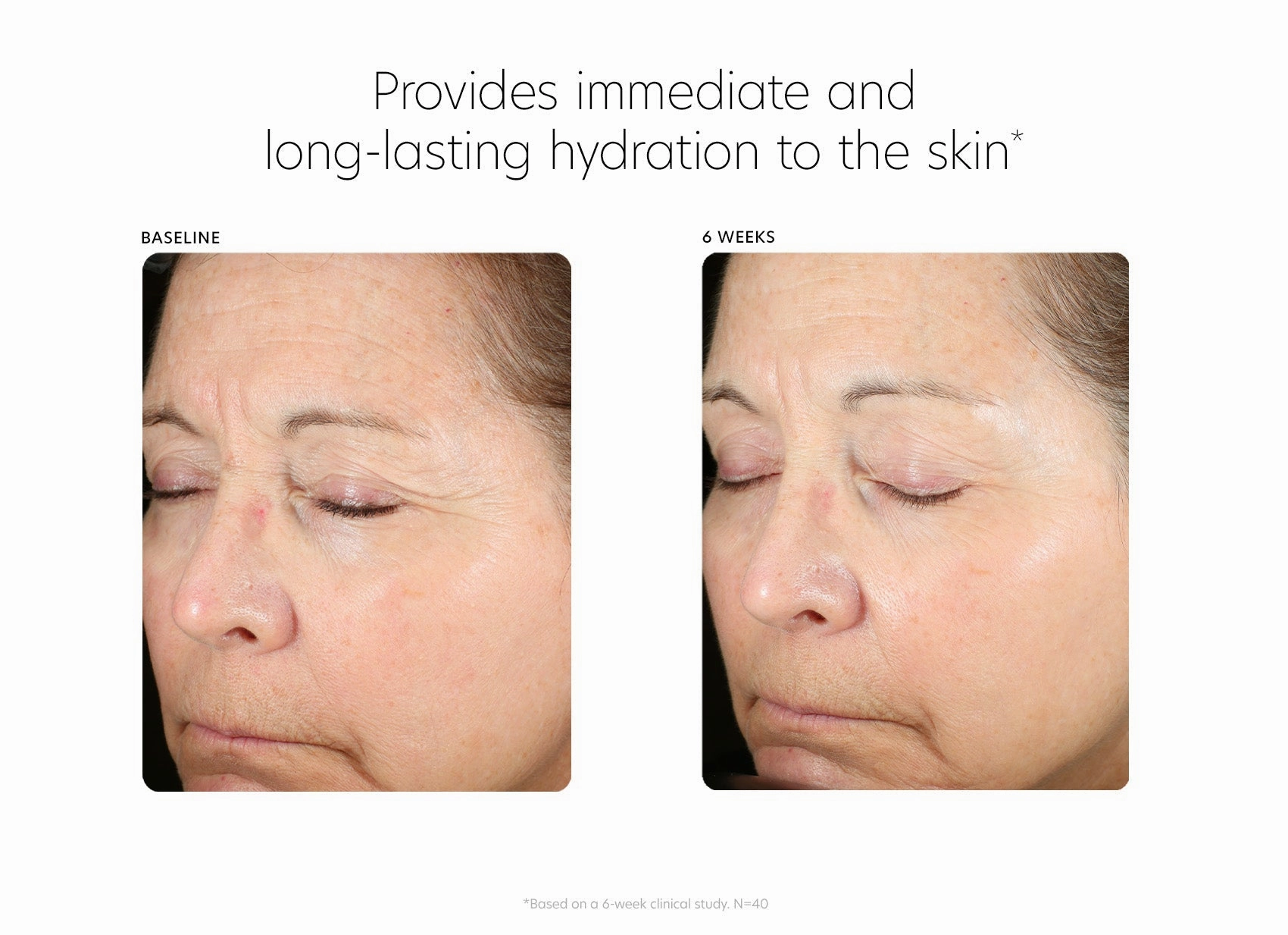 PCA Skin Hyaluronic Acid Boosting Serum 28g