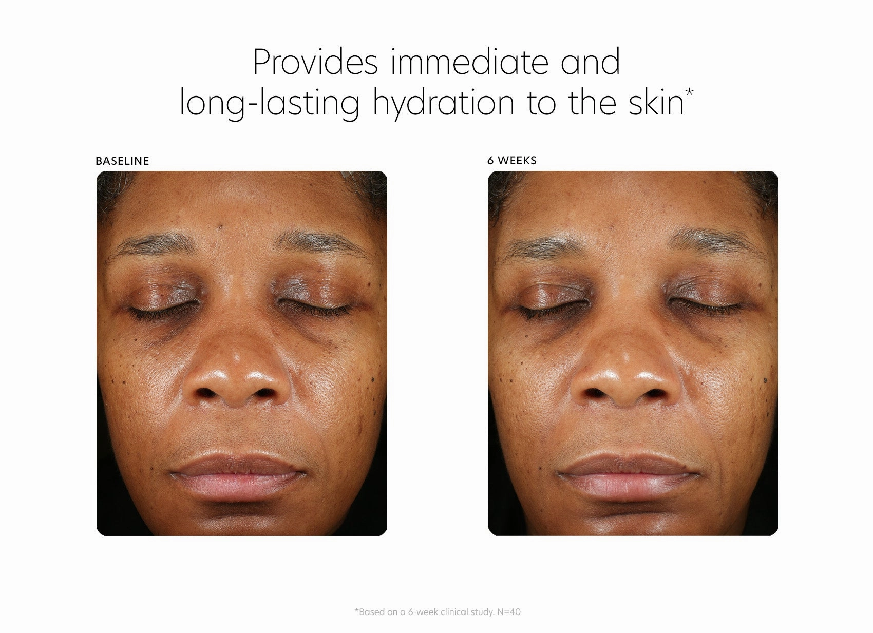 PCA Skin Hyaluronic Acid Boosting Serum 28g