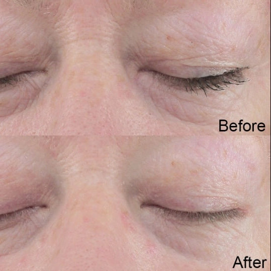 plump: a serum (mini)